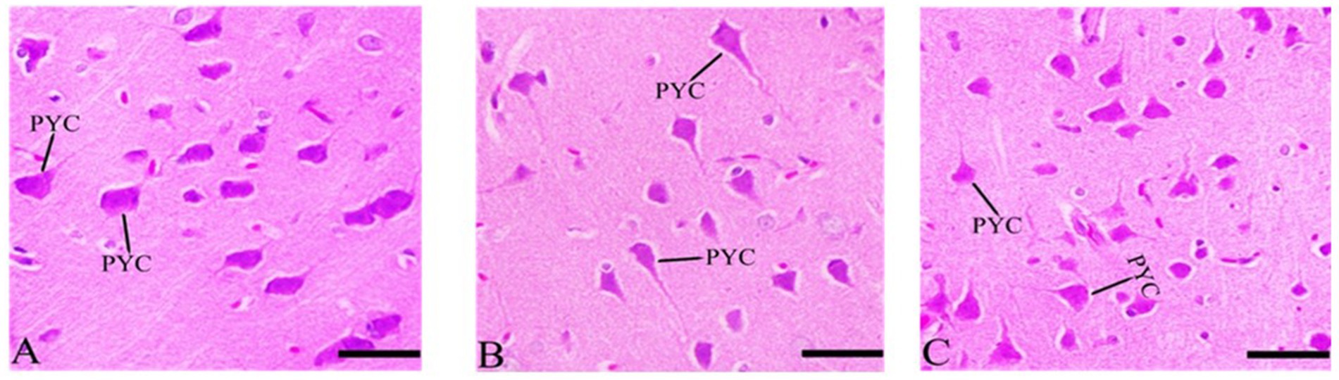 Three microscopic images labeled A, B, and C show brain tissue stained in pink and purple. The label