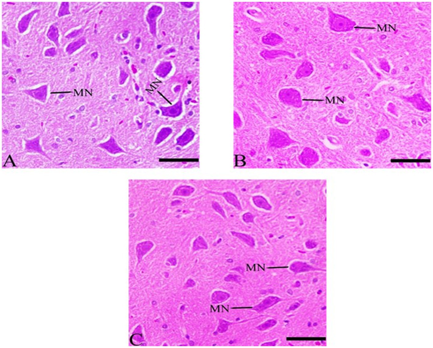 Histological comparison showing three panels labeled A, B, and C, each displaying tissue samples stained in pink and purple. Arrows labeled “MN” indicate motor neurons within the samples. Each panel includes a scale bar for reference.