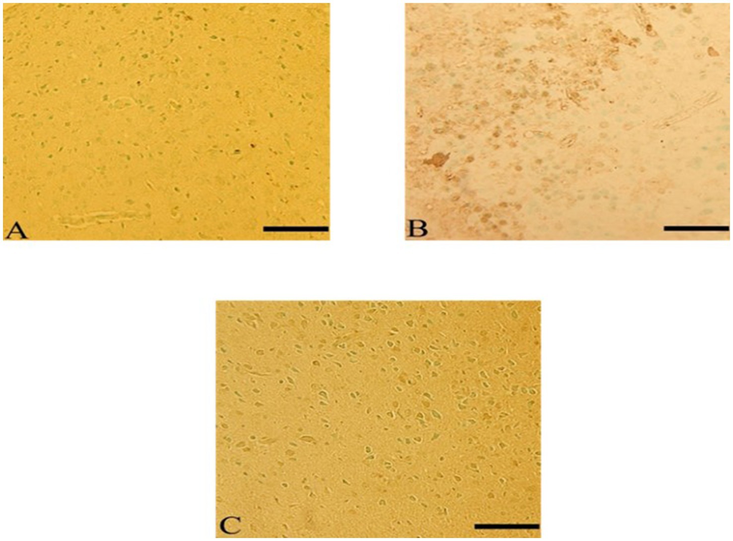 Three microscopy images labeled A, B, and C, each showing clusters of cells with varying densities and shades. Image A and C show a more uniform yellow background with sparsely distributed cells. Image B displays a denser cluster of darker cells on a lighter yellow background. Each image includes a scale bar for reference.