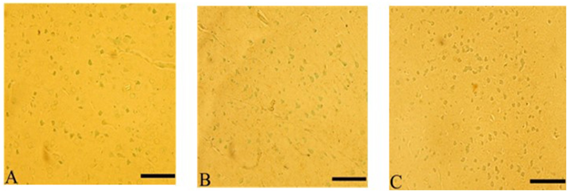 Three microscopic images labeled A, B, and C, each showing a sample with small, scattered greenish and light brown specks on a yellowish background. Black scale bars are present at the bottom of each image.