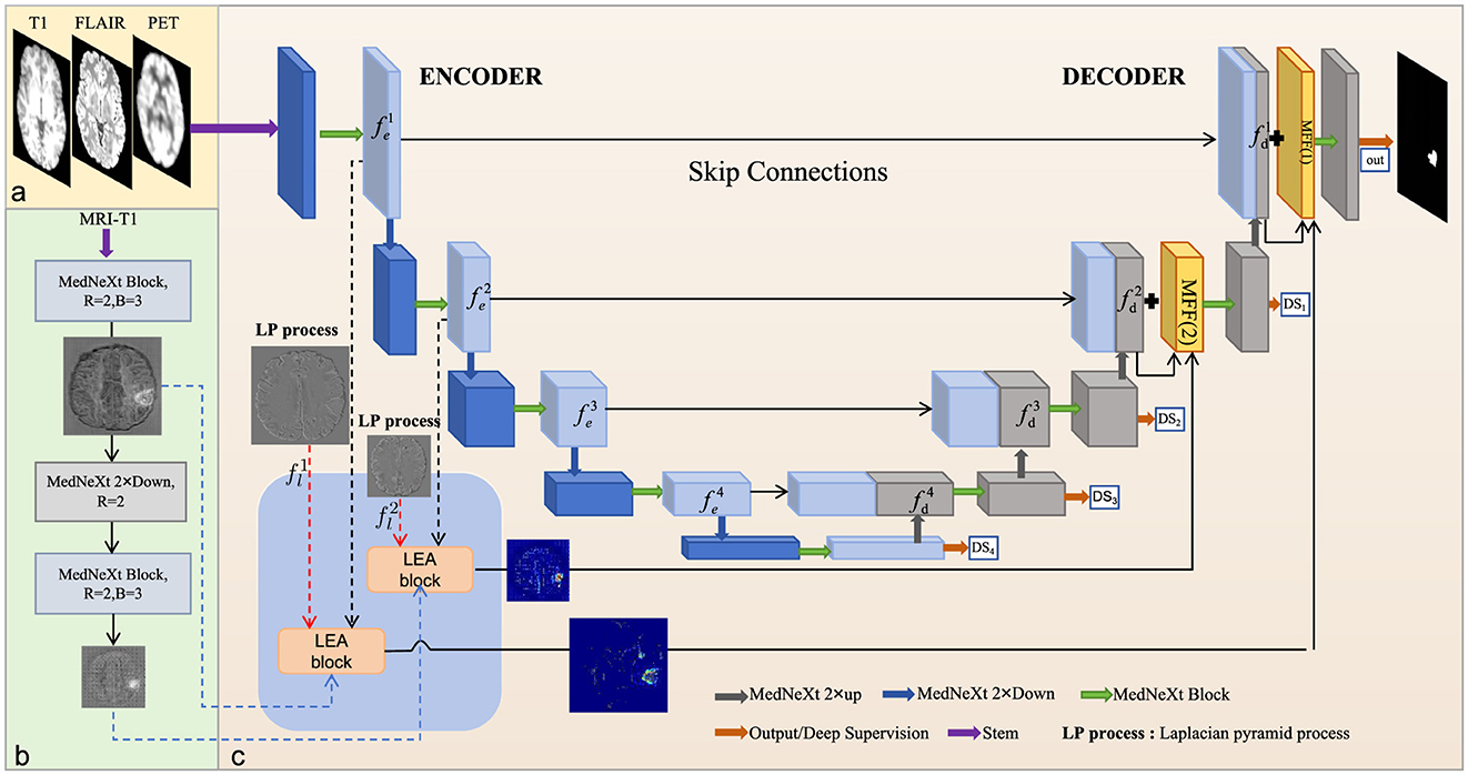 Flowchart of a neural network architecture for medical imaging analysis. It illustrates an encoder-decoder structure with skip connections. The input includes T1, FLAIR, and PET scans. Various blocks such as MedNeXt, LEA, and Laplacian pyramid processes are used. Outputs are shown at the decoder end. Color-coded arrows represent different stages and processes.