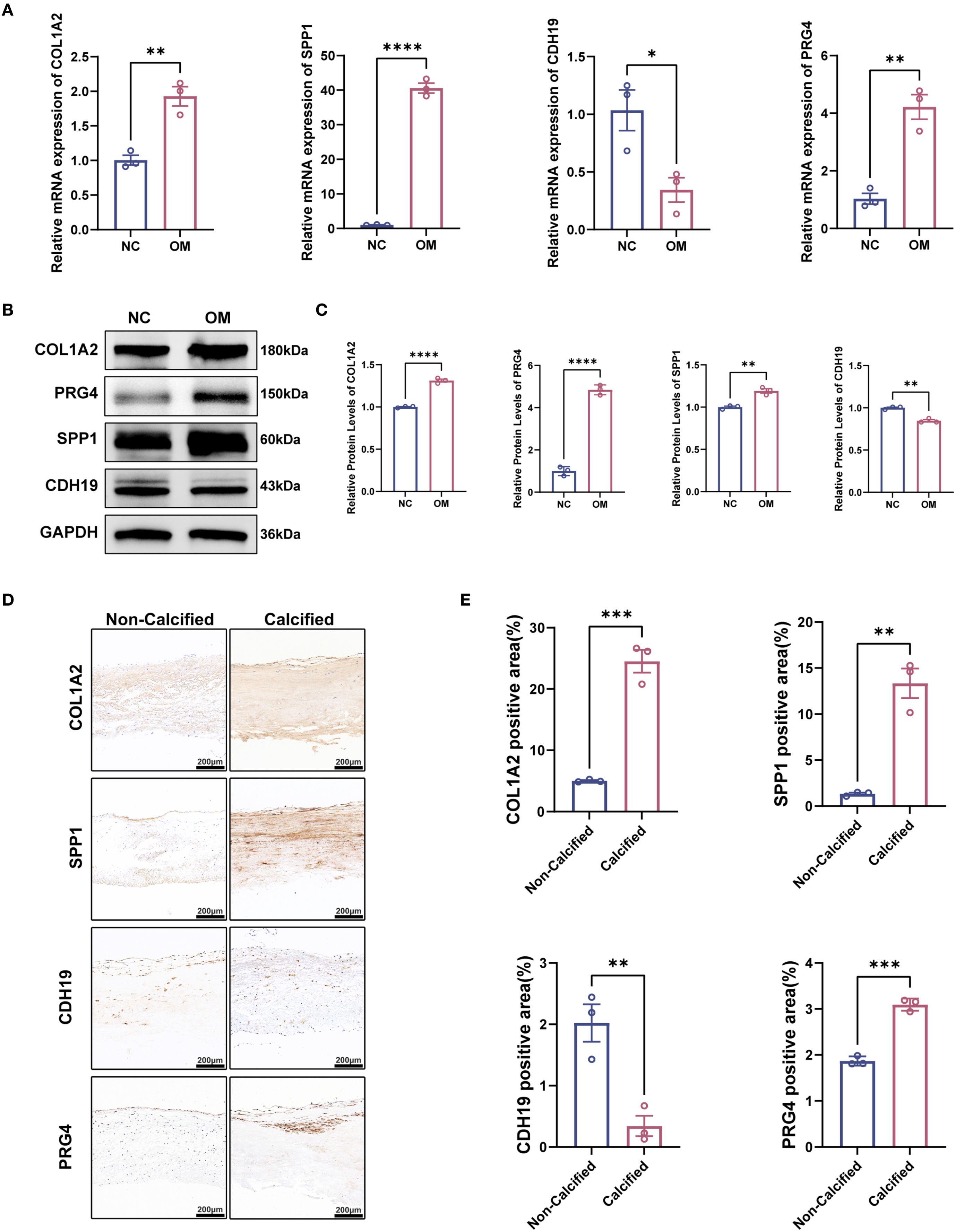 Grouped image displaying experimental data on gene expression and protein levels: A. Bar graphs of mRNA expression levels of COL1A2, SPP1, CDH19, and PRG4 comparing NC and OM groups. Statistical significance indicated by asterisks. B. Western blots showing protein levels of COL1A2, PRG4, SPP1, CDH19, and GAPDH for NC and OM. C. Bar graphs depicting relative protein levels of the same proteins as in B, highlighting significant differences. D. Immunohistochemistry images comparing non-calcified and calcified tissues stained for COL1A2, SPP1, CDH19, and PRG4. E. Bar graphs displaying percentage of positive staining areas for each protein in non-calcified versus calcified tissues, with significance levels noted.