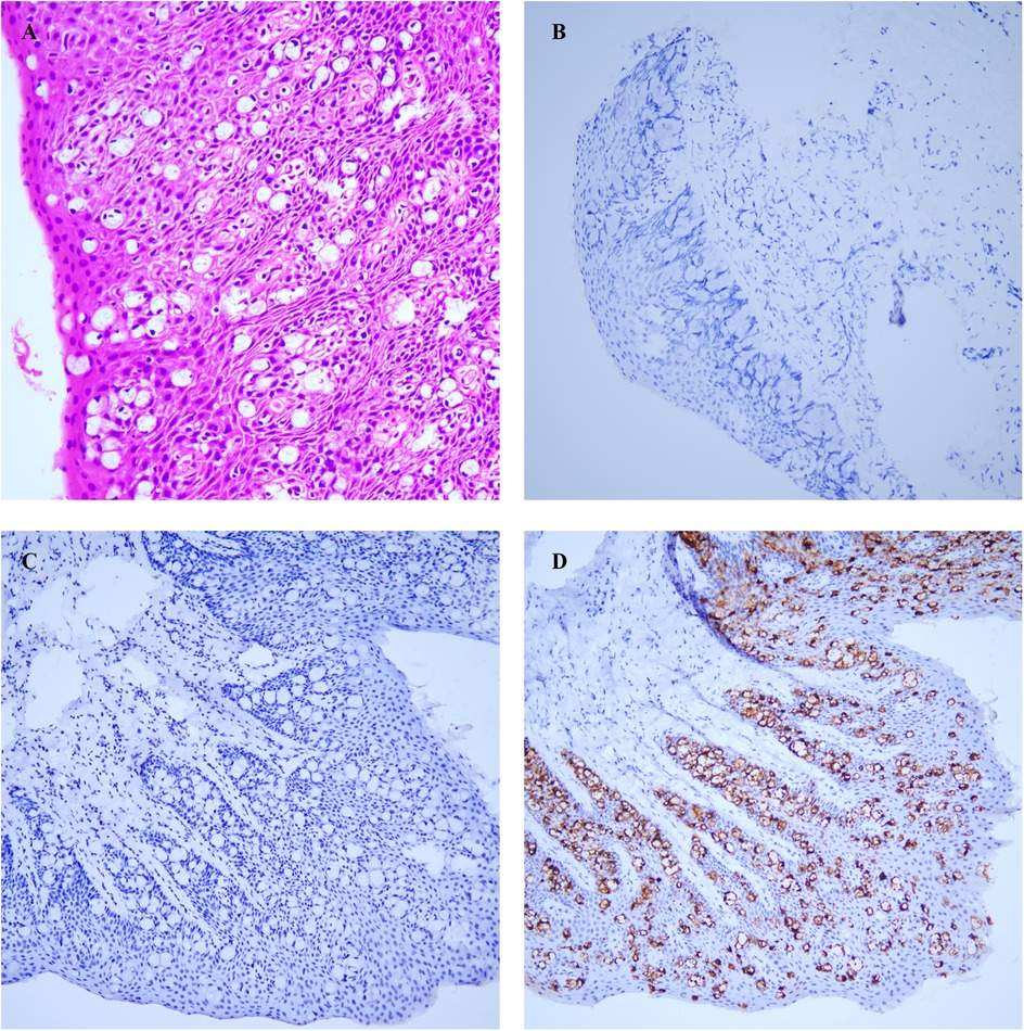Four-panel microscopy image labeled A to D. Panel A shows densely packed cells stained in pink and purple. Panel B is a lighter blue-stained tissue with less detail. Panel C displays a blue-stained pattern with more structure. Panel D shows brown-stained regions indicating cell differentiation.