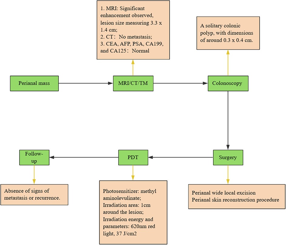 Flowchart depicting the diagnosis and treatment of a perianal mass. Steps include: MRI/CT/TM showing lesion details and normal markers, leading to colonoscopy revealing a colonic polyp. Surgery involves local excision. Post-treatment stages are photodynamic therapy with specified parameters, followed by follow-up showing no metastasis or recurrence. Arrows indicate the flow between steps.