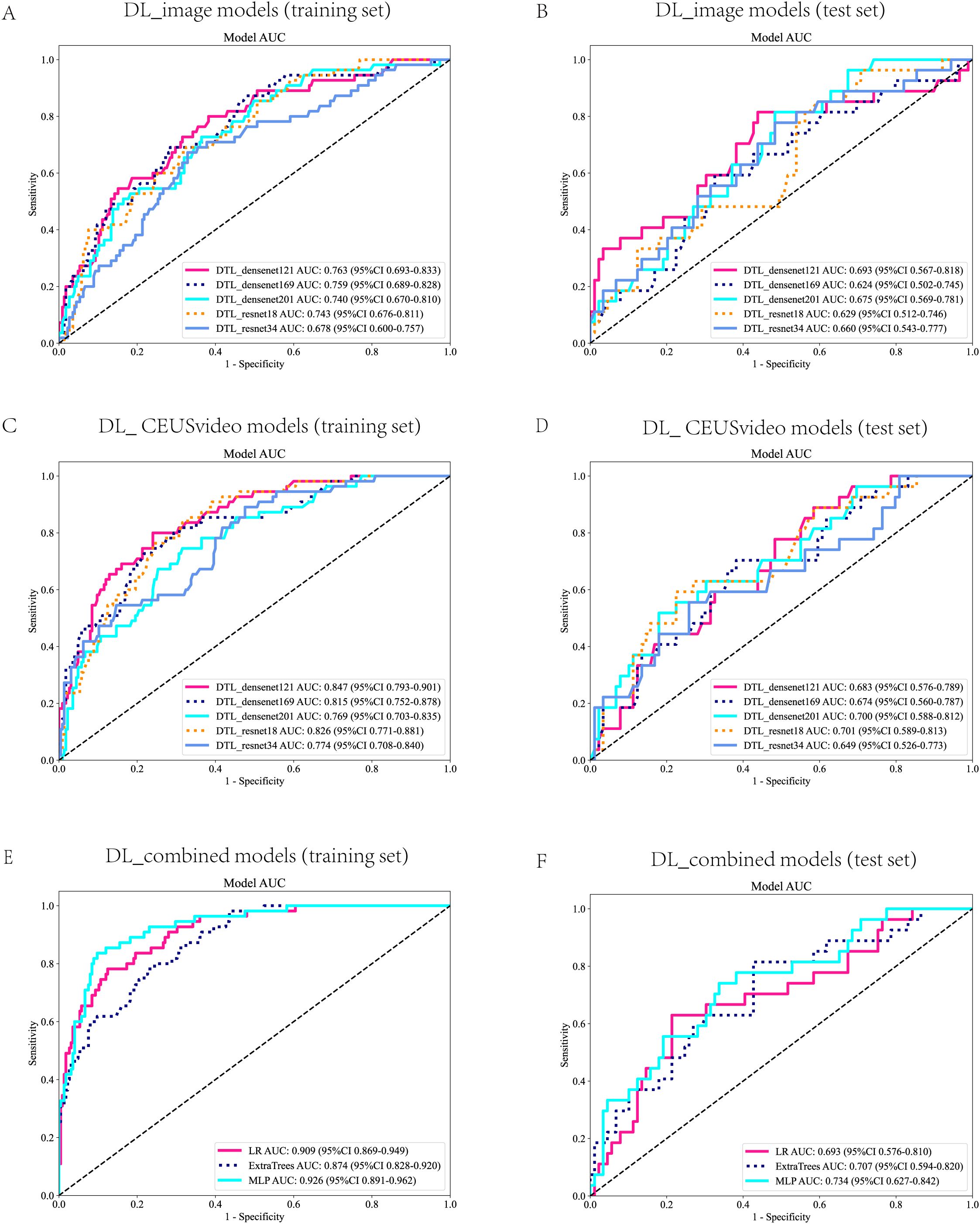 Six ROC curves display model performance across different sets. Panels A and B show DL_image models, panels C and D present DL_CEUSvideo models, while panels E and F illustrate DL_combined models. Each panel compares multiple models with different AUC values. Sensitivity is plotted against 1-Specificity. The comparison between training and test sets is evident from their separations into six distinct panels labeled A to F, each with corresponding models and their AUC with confidence intervals. The diagonal line represents random chance.