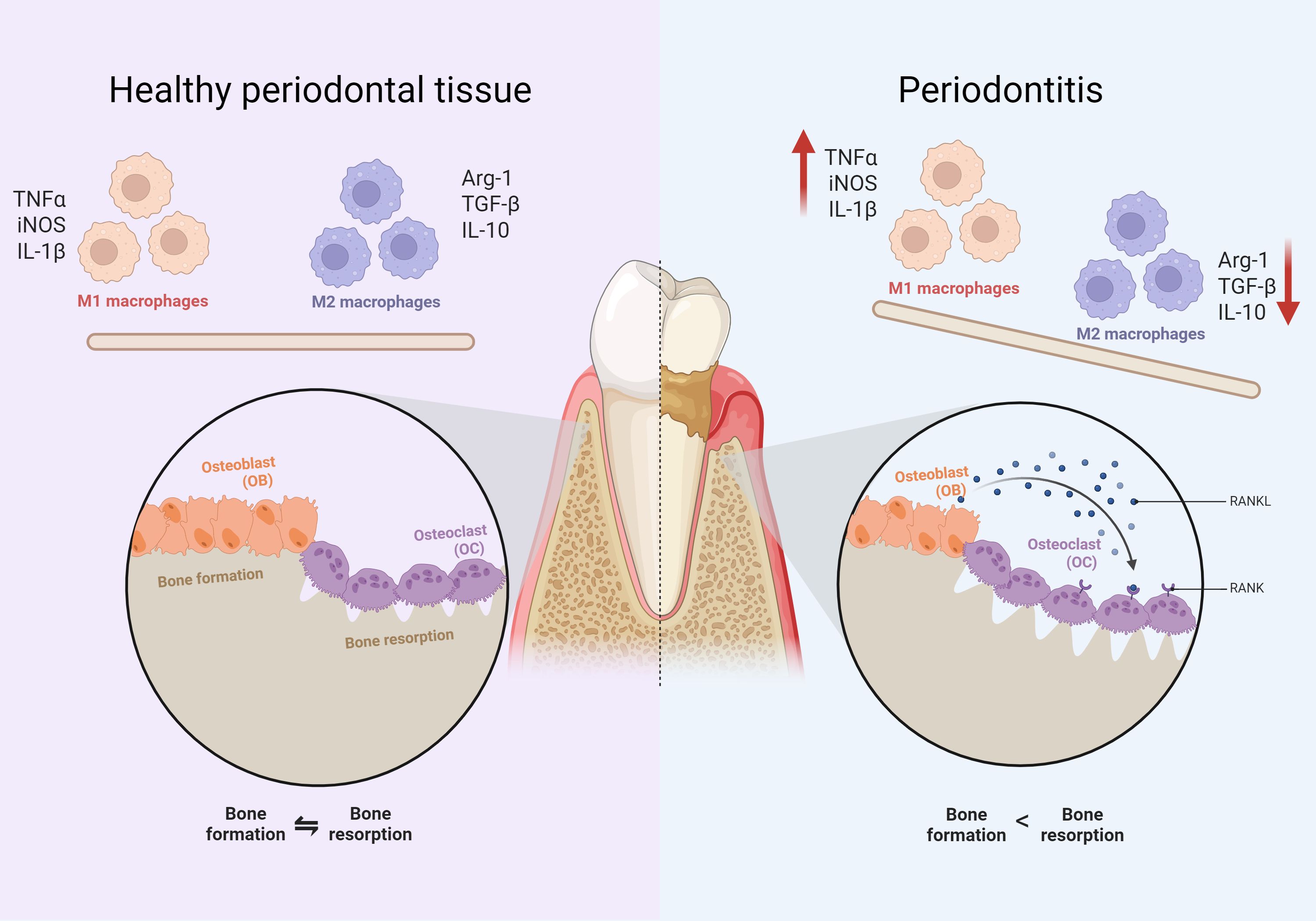 Comparison of healthy periodontal tissue and periodontitis. On the left, healthy tissue shows balanced M1 and M2 macrophages with bone formation equal to resorption. On the right, periodontitis has increased M1 and decreased M2 macrophages, with higher bone resorption than formation. The presence of TNFα, iNOS, IL-1β, Arg-1, TGF-β, IL-10, and RANKL/RANK is indicated.