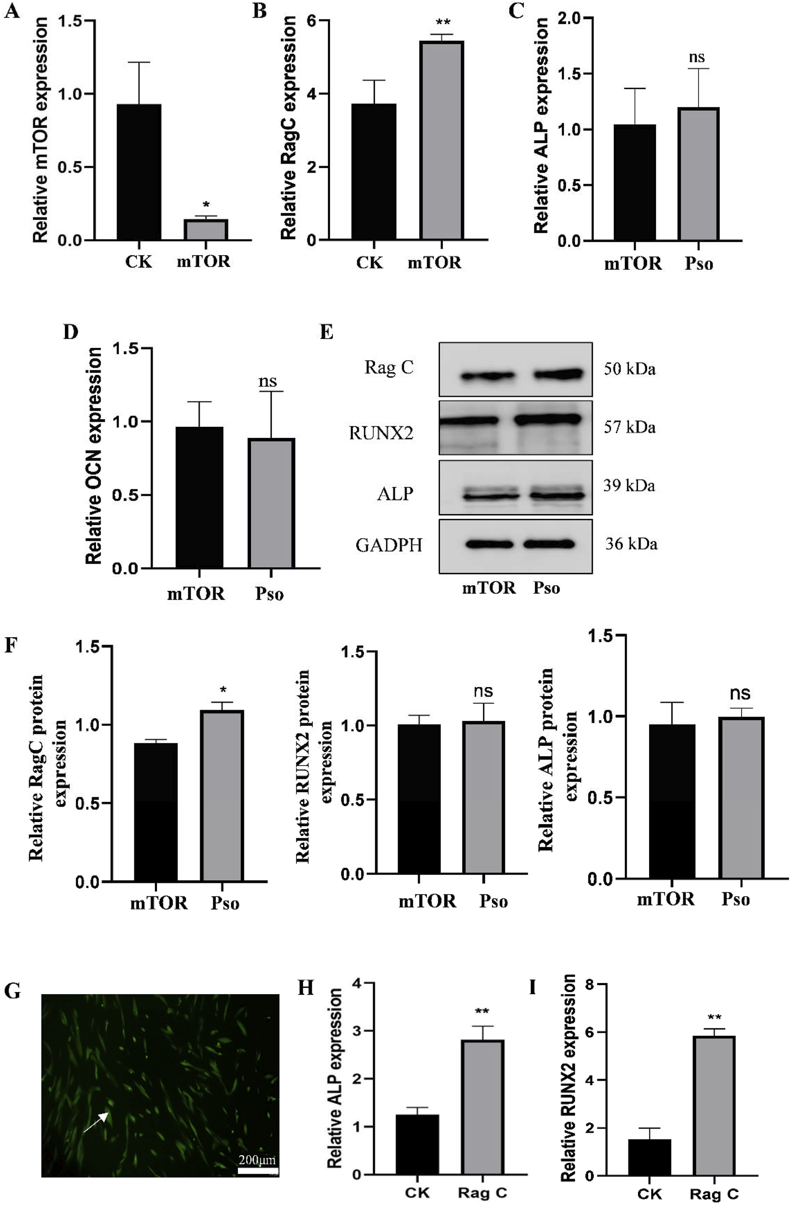 Bar graphs and a western blot image depict various gene and protein expressions under different conditions. Panels A to D show relative mTOR, RagC, ALP, and OCN expressions with statistical significance indicated (*, **). Panel E displays western blot results for Rag C, RUNX2, ALP, and GAPDH proteins. Panel F presents relative protein expressions of Rag C, RUNX2, and ALP. Panel G is a fluorescence microscopy image of lentivirus-transfected PDLSCs. Panels H and I show bar graphs of relative ALP and RUNX2 expressions, respectively, with statistical significance (**). Scale bar in panel G is 200 micrometers.