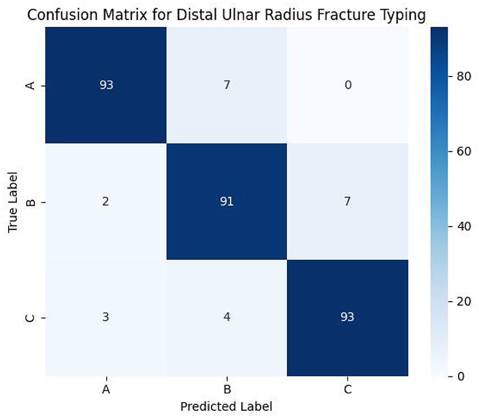Confusion matrix for distal ulnar radius fracture typing with actual labels A, B, and C on the y-axis and predicted labels on the x-axis. True label A: 93 correct, 7 misclassified as B. True label B: 91 correct, 2 misclassified as A, 7 misclassified as C. True label C: 93 correct, 3 misclassified as A, 4 misclassified as B. Color gradient indicates value magnitude.