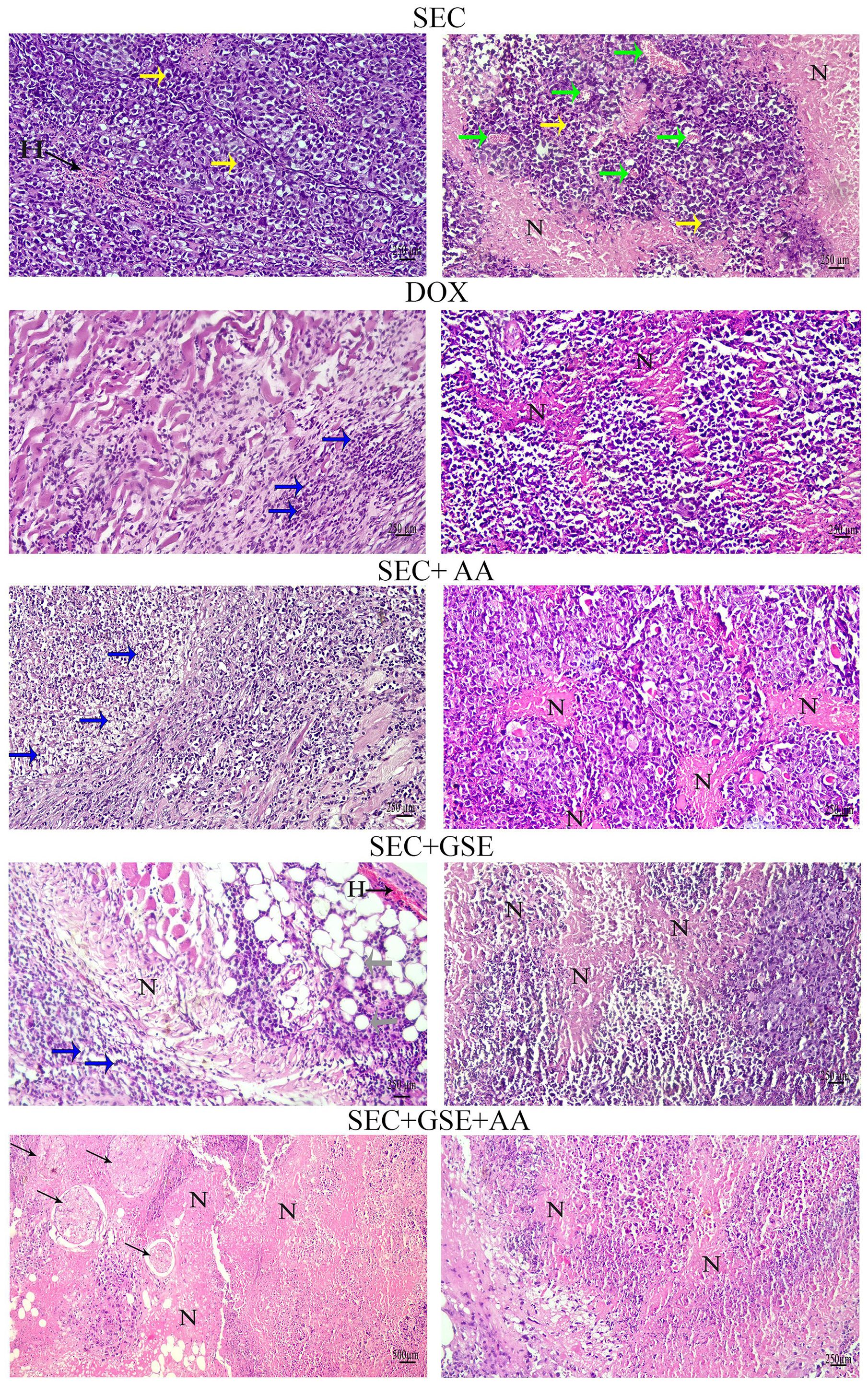 Histological images show liver tissues under various treatments. Each pair, labeled SEC, DOX, SEC+AA, SEC+GSE, and SEC+GSE+AA, highlights differences in liver tissue structure, including cellular changes and necrosis, indicated by arrows and labeled 'N'. Each treatment appears to affect the tissue differently, as observed in the varying density and arrangement of cells.