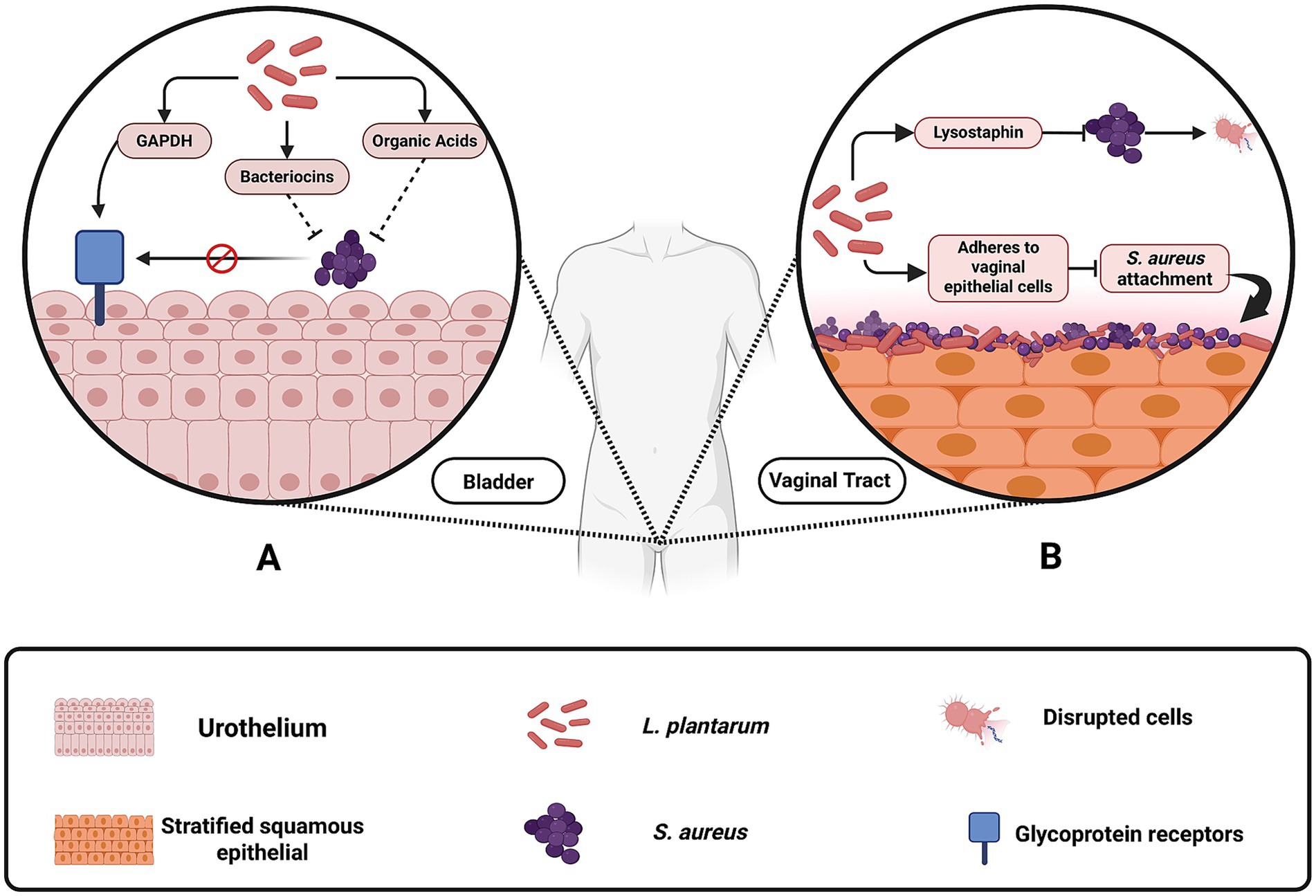 Diagram illustrating two scenarios in the human body: Panel A shows urothelium in the bladder with substances like GAPDH, bacteriocins, and organic acids blocking S. aureus. Panel B shows stratified squamous epithelial cells in the vaginal tract where L. plantarum produces lysostaphin, disrupting attached S. aureus. The key identifies various elements like glycoprotein receptors, disrupted cells, and bacterial types.