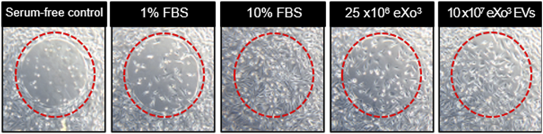 Five-panel image showing cell cultures under different conditions: Serum-free control, 1% FBS, 10% FBS, 25 x 10^8 eXo^3, and 10 x 10^7 eXo^3 EVs. Each panel has a red dashed circle highlighting the cell density and morphology in the central area.