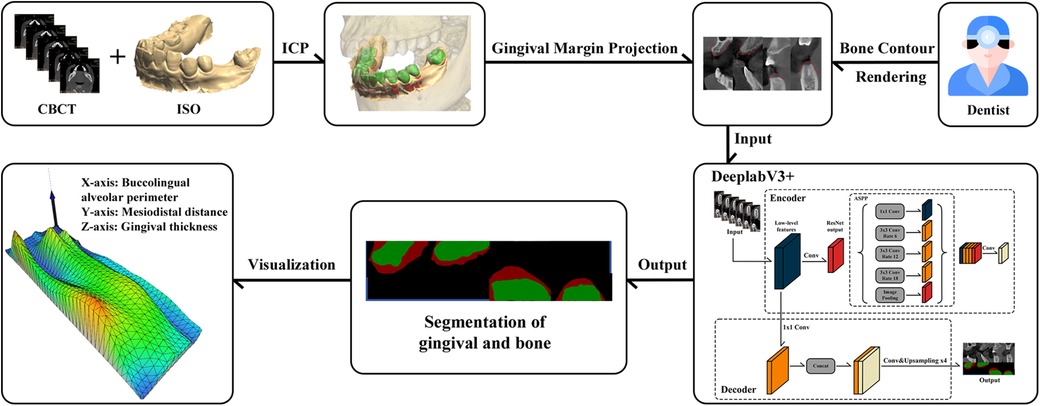 Flowchart depicting gingival and bone segmentation process using CBCT and ISO inputs. The process involves ICP alignment, gingival margin projection, bone contour rendering by a dentist, and visualization using a 3D graph. The segmentation is achieved via DeepLabV3+ with an encoder-decoder structure, resulting in gingival and bone segmentation outputs.