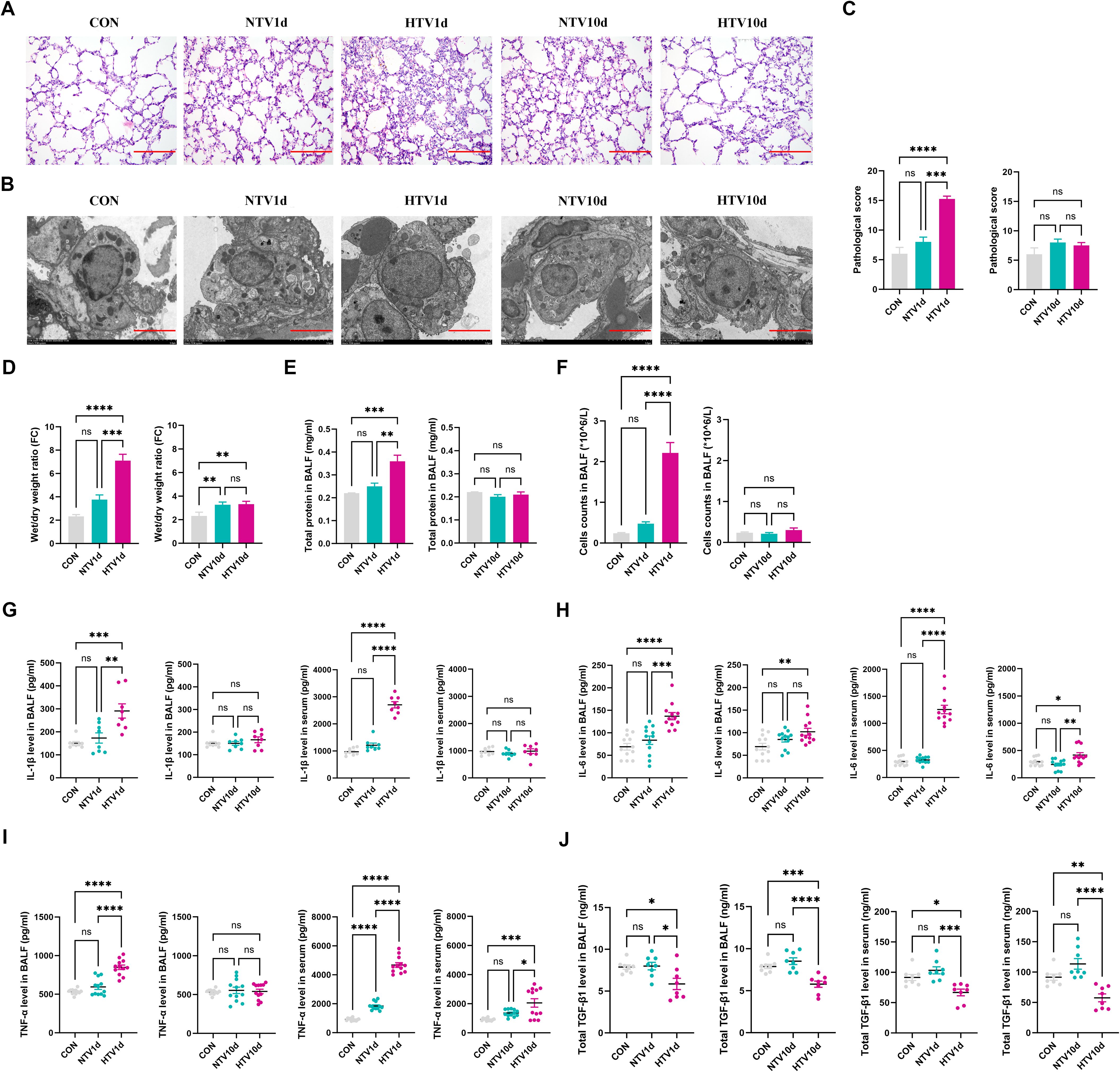 Composite image with multiple panels illustrates experimental results: (A) Microscopic images show tissue samples labeled as CON, NTV1d, HTV1d, NTV10d, HTV10d. (B) Electron micrographs display cellular structures for the same groups. (C-J) Bar and scatter plots assess pathological scores, wet/dry ratio, protein levels, cell counts, and cytokine levels (IL-1β, IL-6, TNF-α, TGF-β1) in various samples, indicating statistically significant differences.