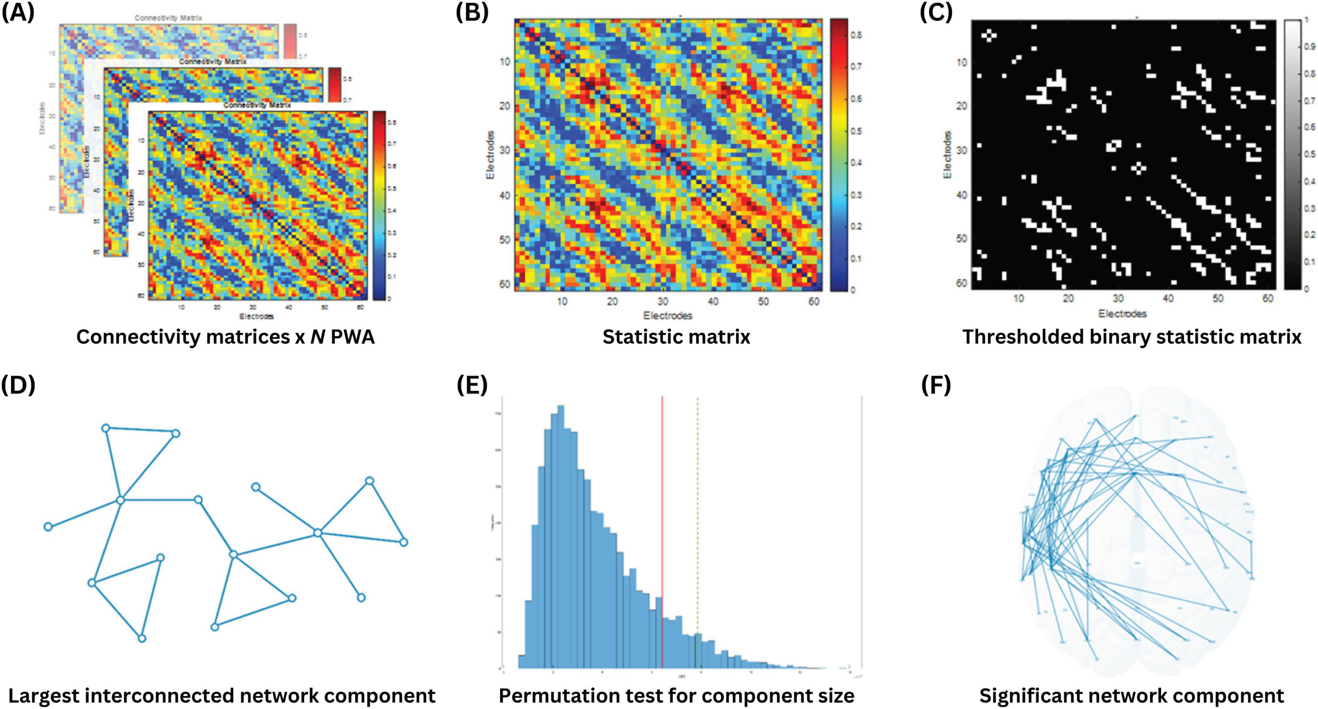 Diagram of brain connections with three panels illustrating AQ-predictive dysfunctome, individual dysfunctome examination, and edge prioritization. Colored lines represent connectivity and centrality rankings: purple for edge centrality, blue to red gradient for connectivity, indicating prioritization of connections based on connectivity and betweenness.
