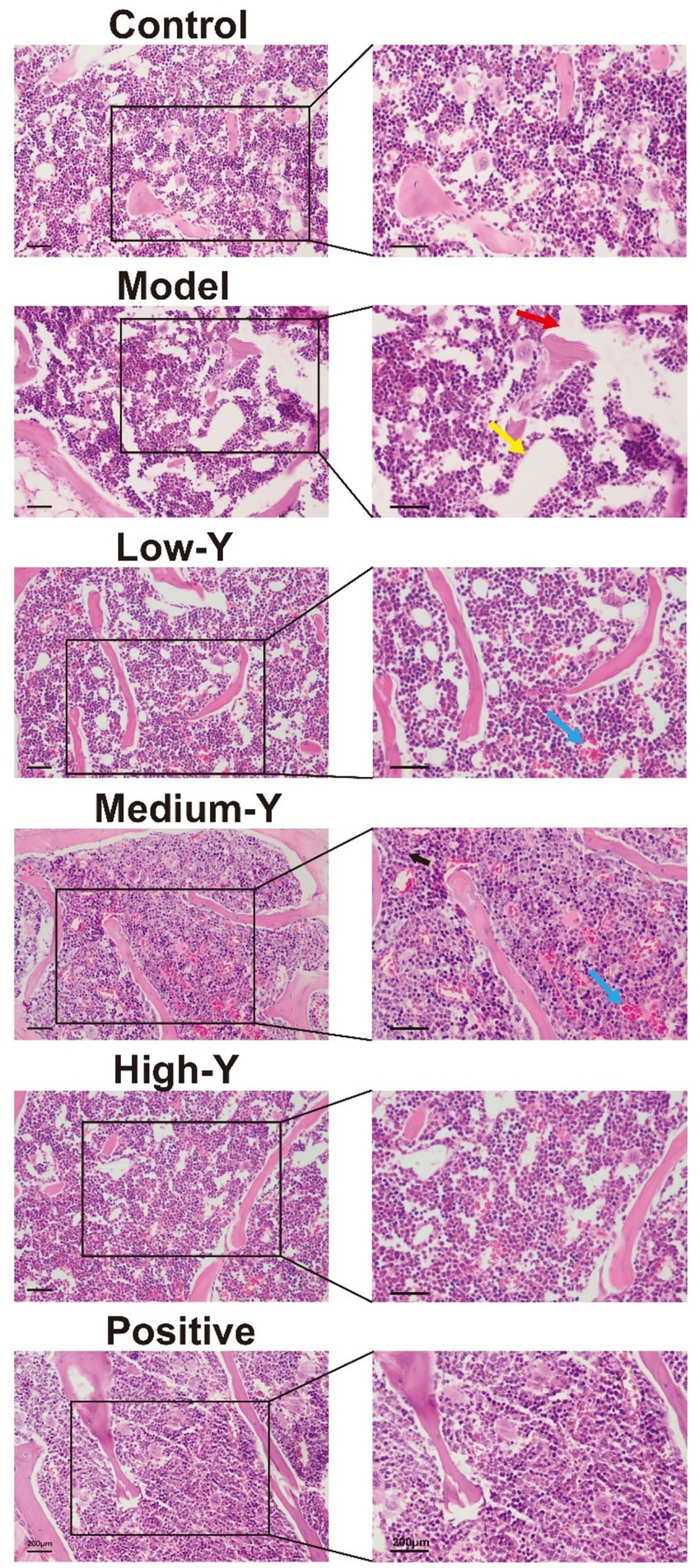 Histological comparison of lung tissue across six conditions: Control, Model, Low-Y, Medium-Y, High-Y, and Positive. Each condition shows a magnified section, highlighting tissue structure and cell distribution differences. Various features are indicated with colored arrows. Scale bars are present for reference.