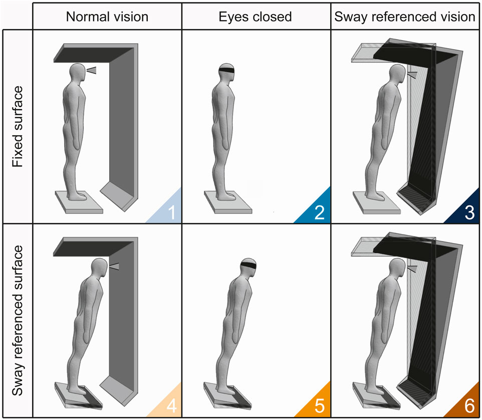 Diagram showing six scenarios of balance testing. Top row: normal vision on a fixed surface, eyes closed on a fixed surface, and sway-referenced vision on a fixed surface. Bottom row: normal vision on a sway-referenced surface, eyes closed on a sway-referenced surface, and sway-referenced vision on a sway-referenced surface. Each depicts a person standing on a platform with varying visual and surface conditions.