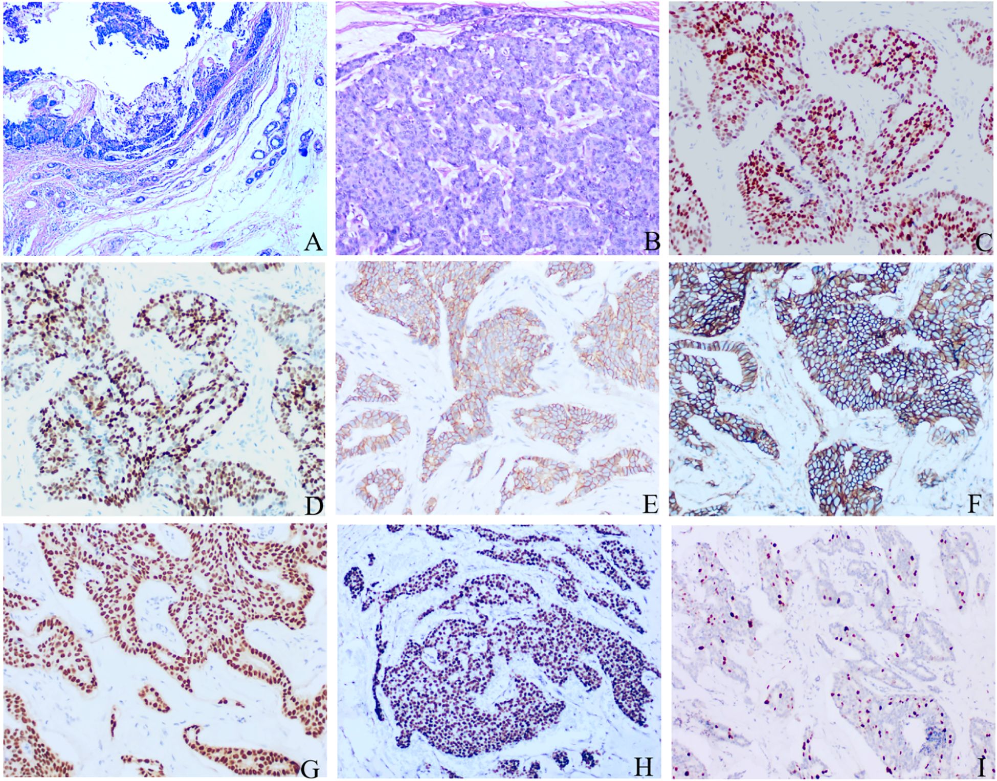 Histological slides labeled A to H show various tissue samples stained to highlight cellular structures and molecules. Slide A presents blue-stained collagen fibers; B shows cellular detail in purple; C and D display nuclei with intense red staining; E and F highlight cell membranes with brown staining; G features dense red nuclear staining; H shows circular cellular arrangement with purple staining.