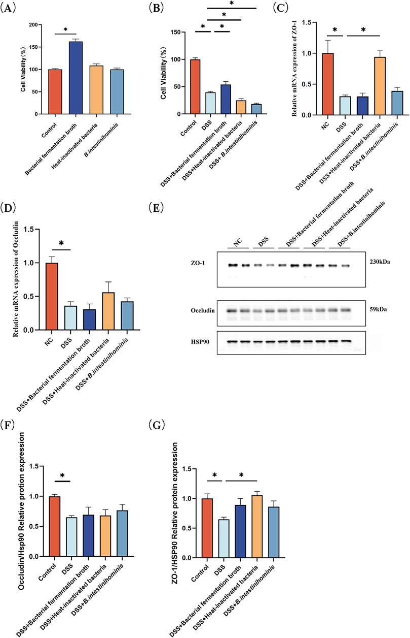 Bar charts and a Western blot panel showing cell viability, mRNA, and protein expression comparisons among different treatments: bacterial fermentation broth, heat-inactivated bacteria, and B. intestinihominis, with and without DSS. Significant statistical differences are marked with asterisks. Microscopic images show cell samples treated under various conditions: NC, DSS, bacterial fermentation broth, heat-inactivated bacteria, and *B. intestinihominis*. Panel (H) depicts ZO-1 in green, DAPI-stained nuclei in blue, and merged images. Panel (I) shows occludin in green, DAPI-stained nuclei, and merged images. Each condition is consistently compared, with markers highlighting cellular structures. Scale bars indicate one hundred micrometers for each sample.
