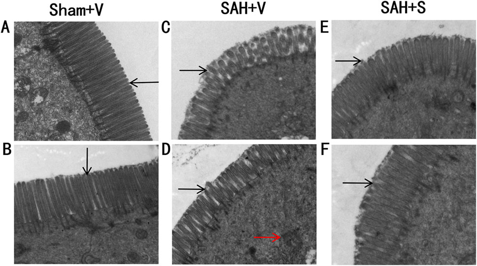 Electron microscopy images showing cochlear hair cell stereocilia in different conditions. Panels A and B (Sham+V) display intact stereocilia with uniform structure. Panels C and D (SAH+V) show structural disruptions and irregularities in the stereocilia. Panels E and F (SAH+S) demonstrate improved stereocilia structure with noticeable recovery. Black arrows point to stereocilia, while the red arrow indicates structural damage in panel D.