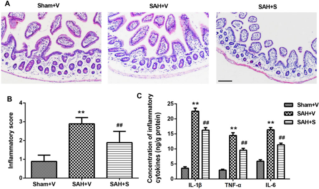 Panel A shows histological images of intestinal tissues stained to illustrate inflammation: Sham+V, SAH+V, and SAH+S, with varying inflammation levels. Panel B is a bar graph displaying inflammatory scores, with SAH+V showing higher scores than Sham+V and SAH+S. Panel C shows bar graphs of inflammatory cytokine concentrations (IL-1β, TNF-α, IL-6) in ng/g protein, highlighting elevated levels in SAH+V compared to Sham+V and SAH+S. Asterisks indicate statistical significance.