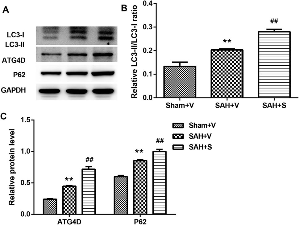 Western blot and bar graphs showing protein expression levels. Panel A displays bands for LC3-I, LC3-II, ATG4D, P62, and GAPDH. Panel B shows the LC3-II/LC3-I ratio for Sham+V, SAH+V, and SAH+S groups, with SAH+S having the highest ratio. Panel C presents the relative protein levels of ATG4D and P62, with SAH+S exhibiting the highest levels. Statistical significance is indicated by asterisks and hashtags.