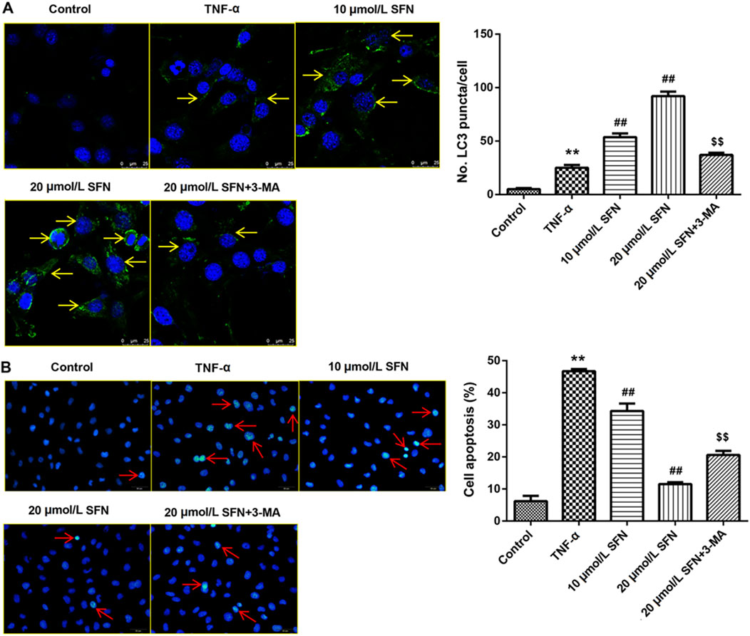 Fluorescent microscopy images and bar graphs depicting cellular responses to treatments. In panel A, cell images with LC3 puncta are shown under control, TNF-α, and varying concentrations of SFN with arrows indicating LC3 puncta. The bar graph quantifies LC3 puncta per cell. In panel B, cell images show apoptotic changes with arrows under similar conditions, and the bar graph depicts cell apoptosis percentages. Treatments include TNF-α, 10 µmol/L SFN, 20 µmol/L SFN, and 20 µmol/L SFN+3-MA, showing varied effects on autophagy and apoptosis.