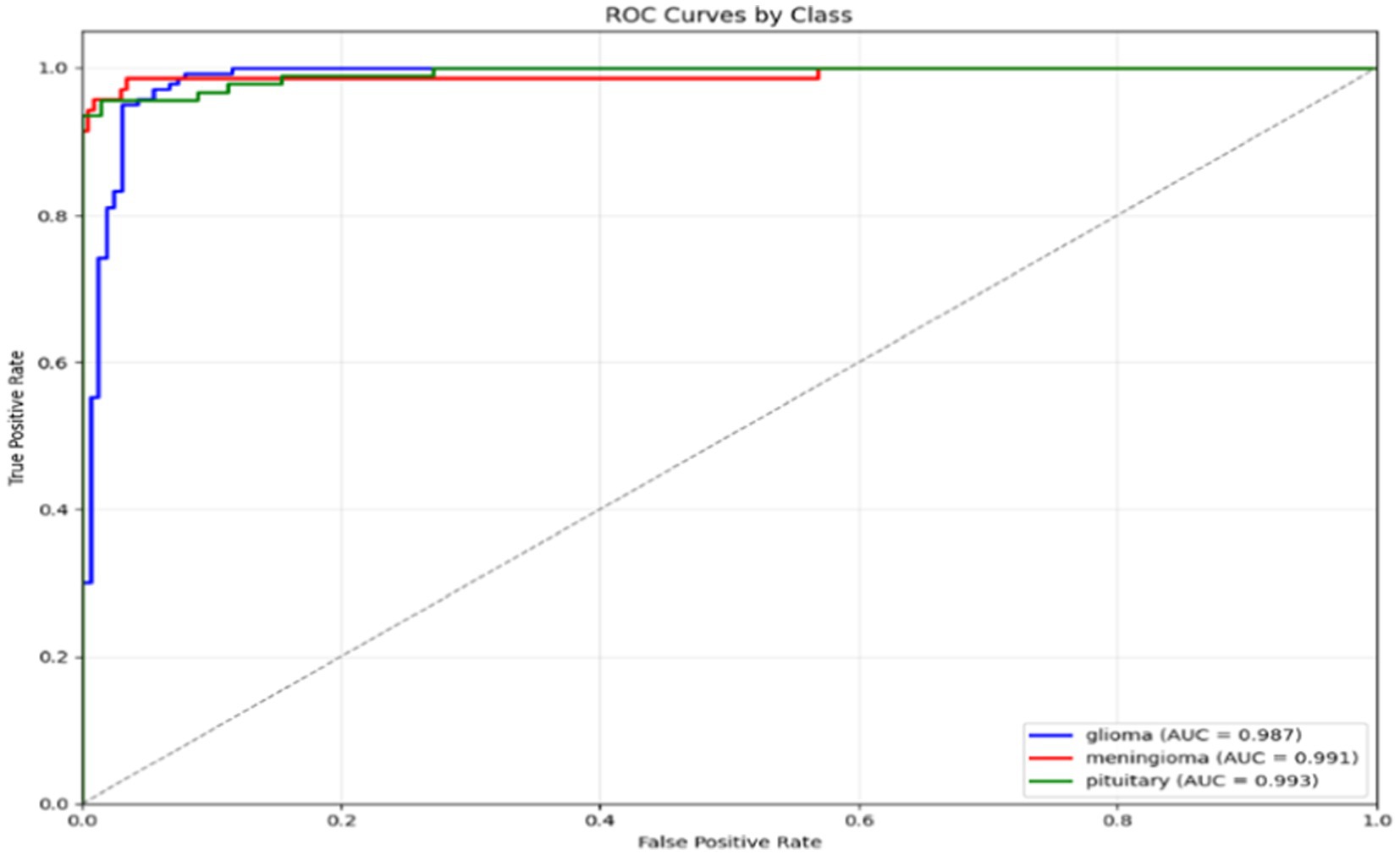 ROC curve chart showing three classes: glioma (blue), meningioma (red), and pituitary (green). The x-axis represents the false positive rate, and the y-axis the true positive rate. Glioma has an AUC of 0.987, meningioma 0.991, and pituitary 0.993, indicating high classification accuracy.