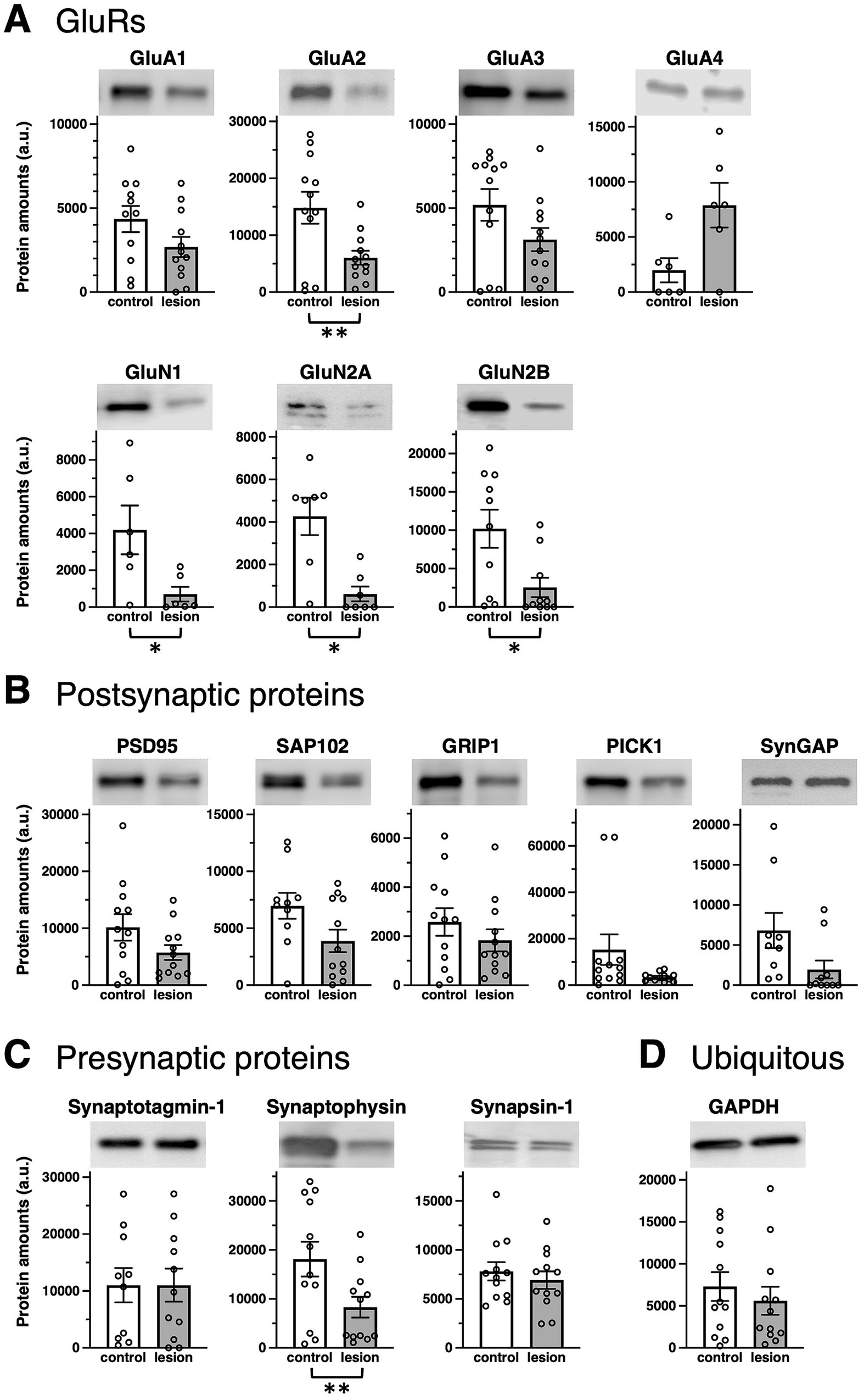 Bar graphs with western blot images showing protein amounts in control and lesion samples. Panel A displays various GluR proteins like GluA1-A4, GluN1, and GluN2A-B, showing significant decreases in lesion samples. Panel B highlights postsynaptic proteins such as PSD95 and SynGAP, with varied changes. Panel C shows presynaptic proteins, notably decreased Synaptophysin in lesion samples. Panel D shows the ubiquitous protein GAPDH, with no significant difference. Statistical significance is marked with asterisks.