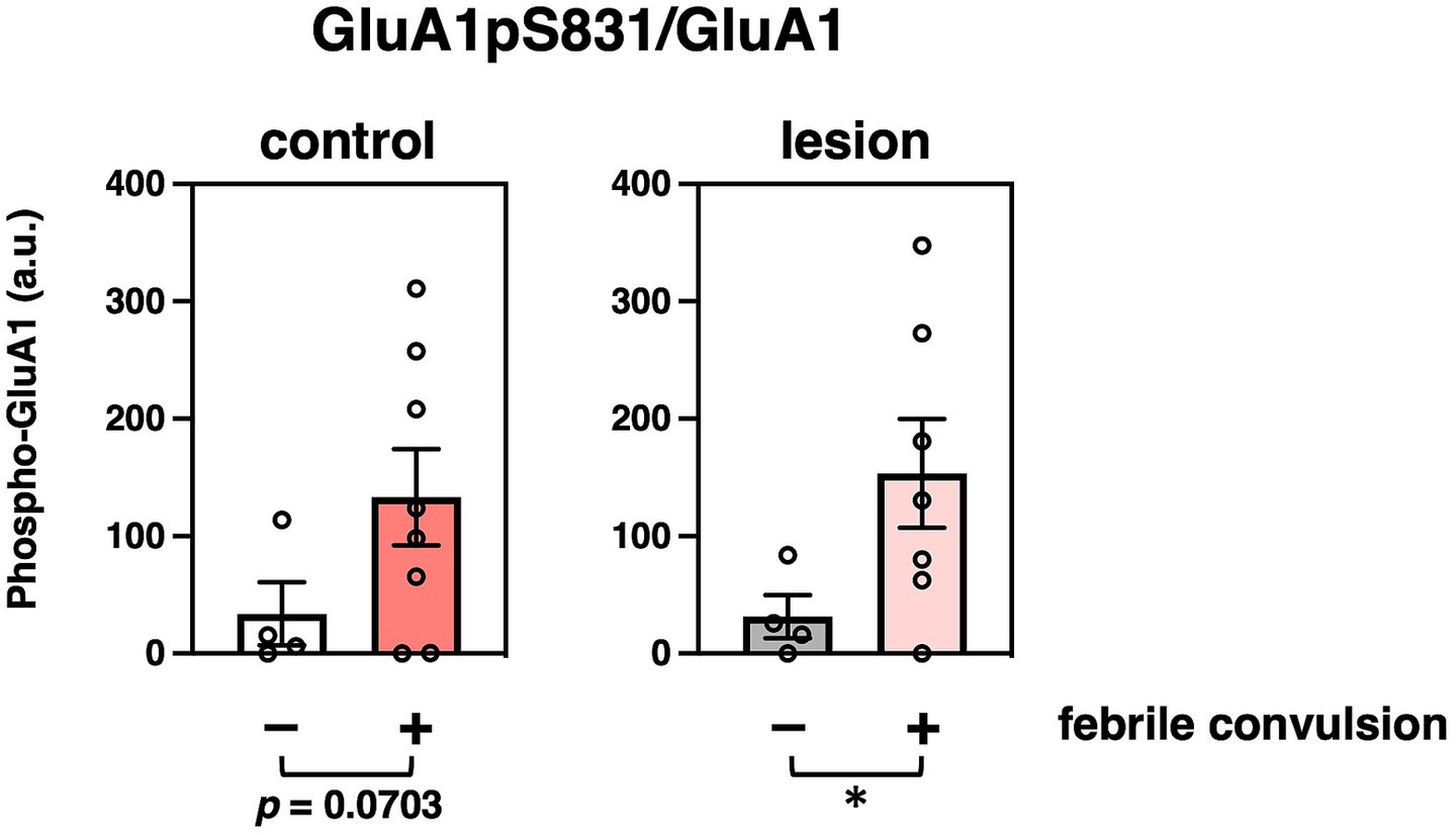 Bar graph comparing Phospho-GluA1 levels in control and lesion groups, each divided into febrile convulsion absent and present. Both groups show higher levels with convulsions (+). Statistical significance (*) is noted for the lesion group with p = 0.0703 for control.