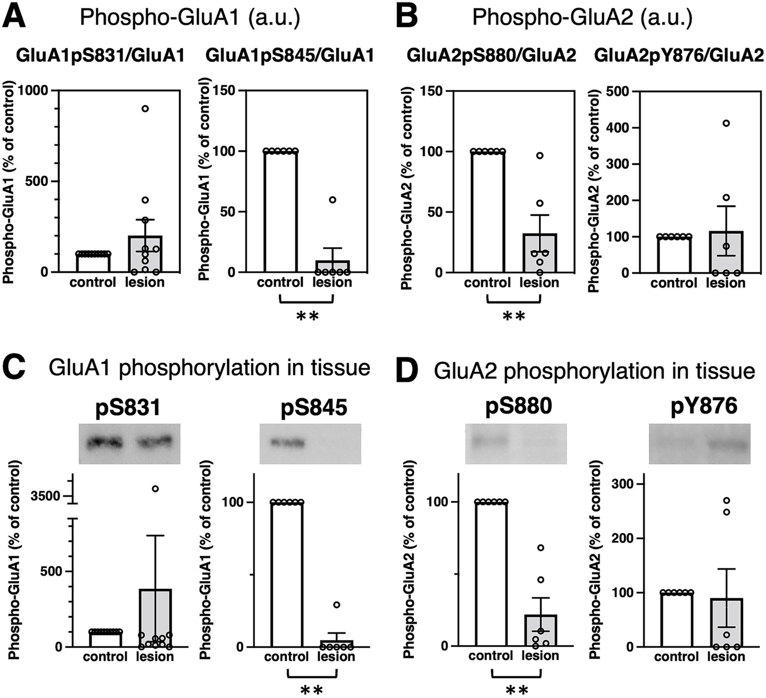 Bar graphs and western blot images depict phosphorylation levels of GluA1 and GluA2 in control and lesion tissues. Figures A and B display bar graphs comparing phospho-GluA1 (S831 and S845) and phospho-GluA2 (S880 and Y876) ratios, highlighting significant decreases in lesion tissues. Figures C and D present corresponding blots and quantitative analyses, reinforcing phospho-GluA1 decrease at sites S831 and S845 and phospho-GluA2 decrease at site S880 in lesion samples, with variants expressed as a percentage of control. Asterisks denote statistical significance.