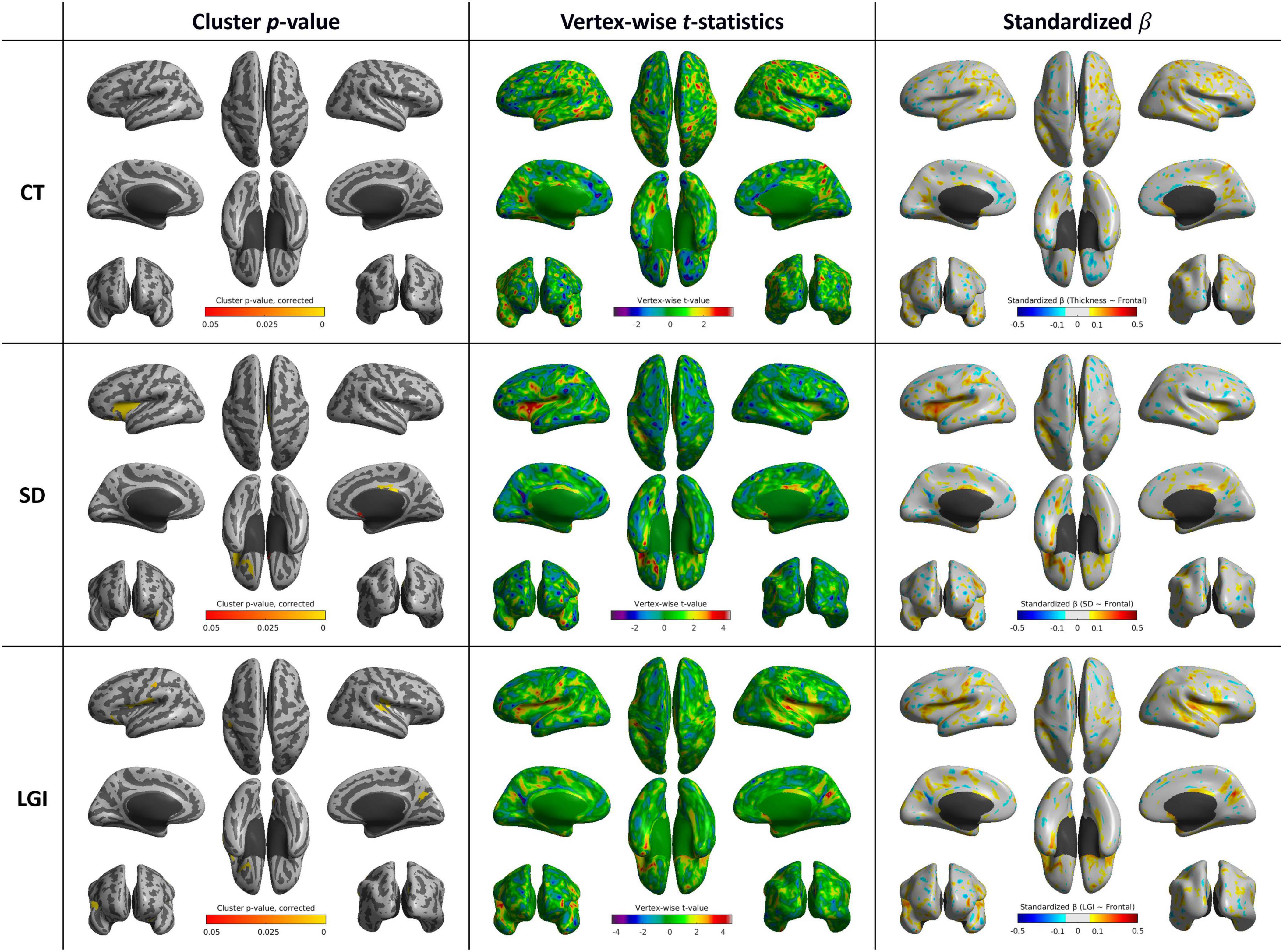 Brain imaging results displayed in three rows and columns. Rows represent CT, SD, and LGI data parameters. Columns show cluster p-values, vertex-wise t-statistics, and standardized beta values. Color-coded scales are used for data interpretation, indicating variations in brain structure metrics.