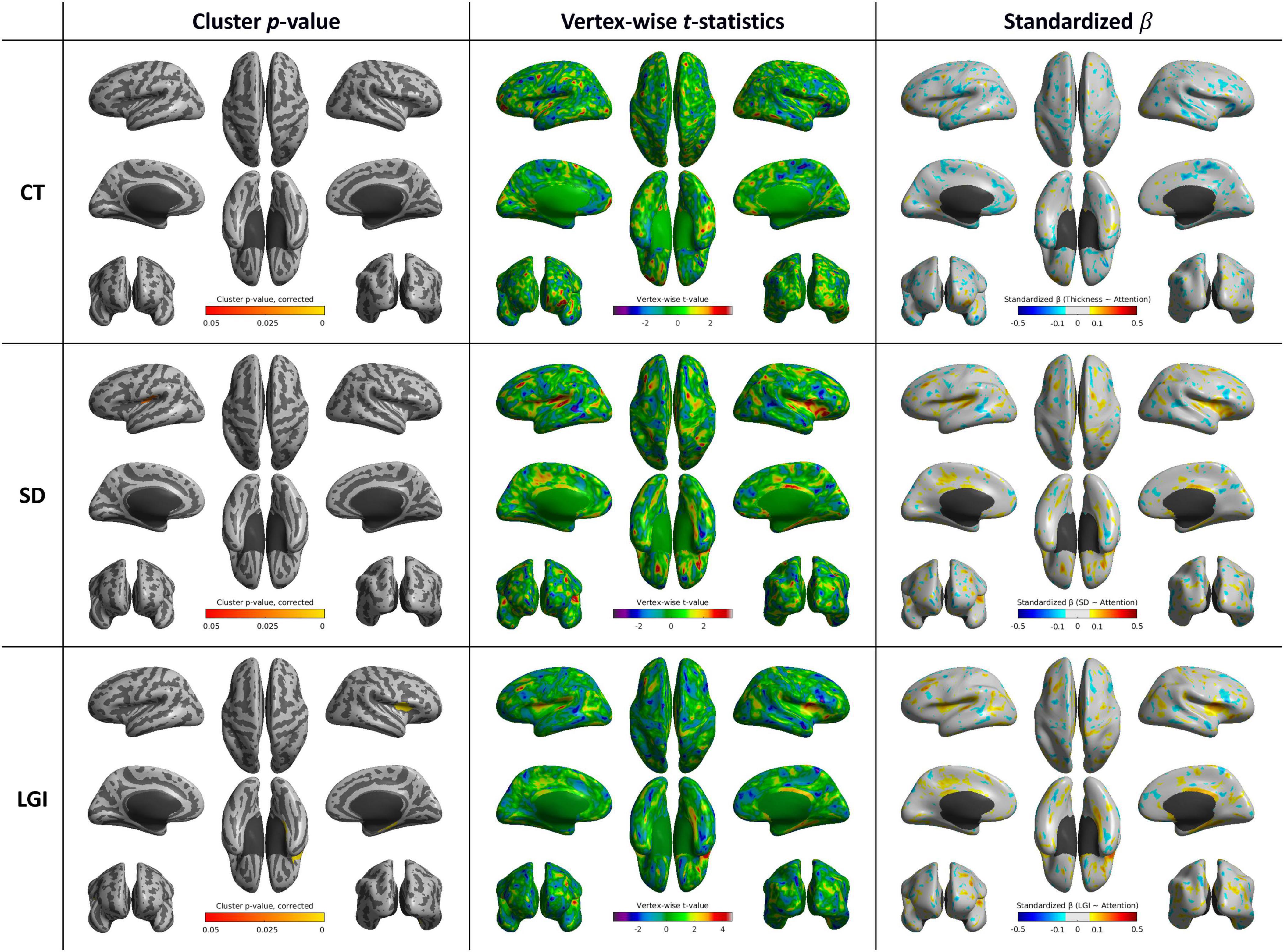 Brain imaging analysis comparing CT, SD, and LGI across three metrics: cluster p-value, vertex-wise t-statistics, and standardized beta. Each row represents a different metric: CT, SD, and LGI. Columns display brain surface visualizations for cluster p-values (grayscale), vertex-wise t-statistics (color-scaled), and standardized beta values (color-scaled). Color bars indicate value ranges, with p-values from zero point zero five to zero point zero two three, t-statistics from negative two to two, and beta values from negative zero point five to zero point five.