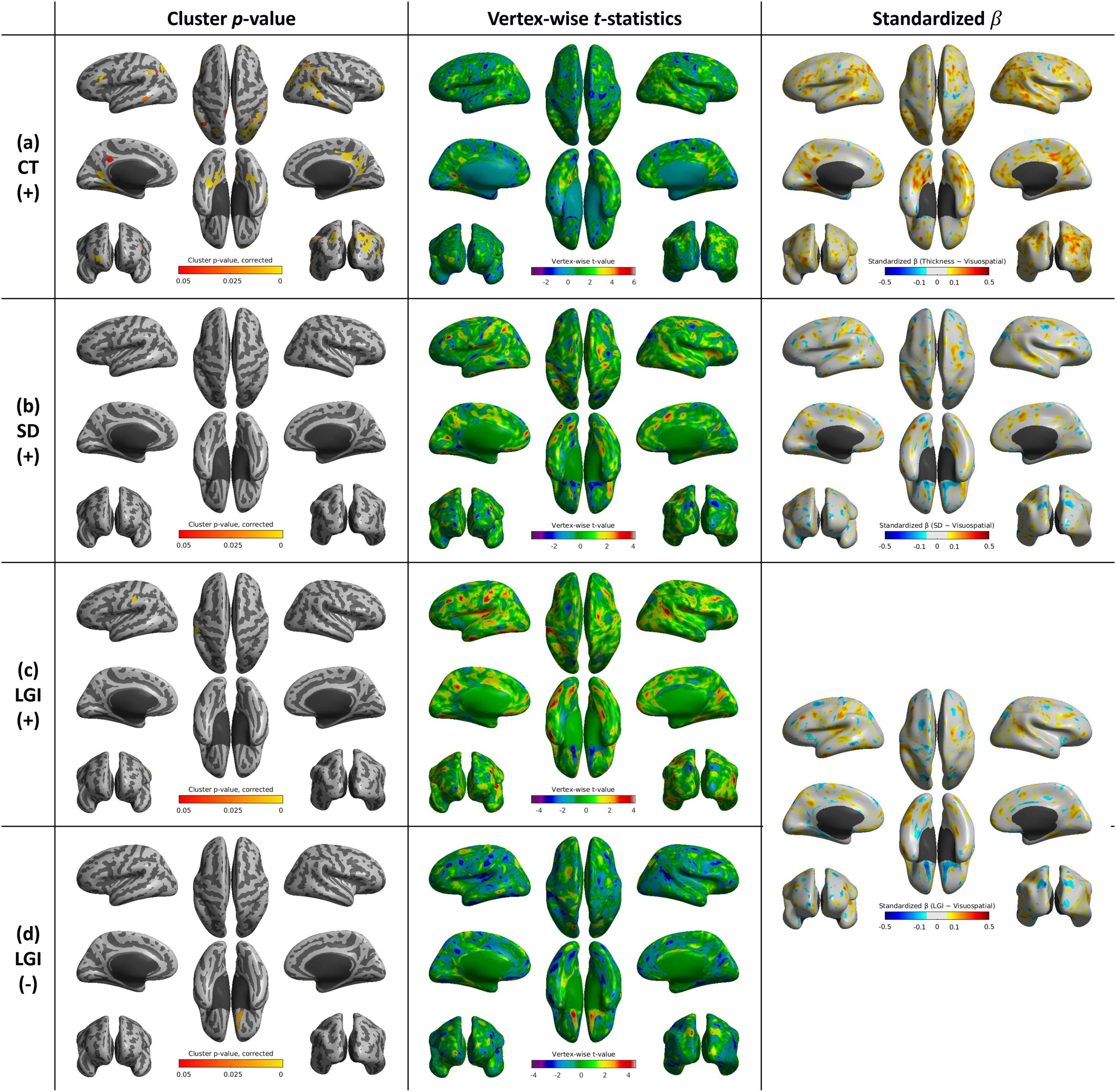Brain surface visualizations arranged in a 4x3 grid depicting cluster p-values, vertex-wise t-statistics, and standardized beta values for different cortical measures: CT (+), SD (+), LGI (+), and LGI (-). Each column shows a different statistical parameter with corresponding color scales, illustrating variations across the brain surface models.