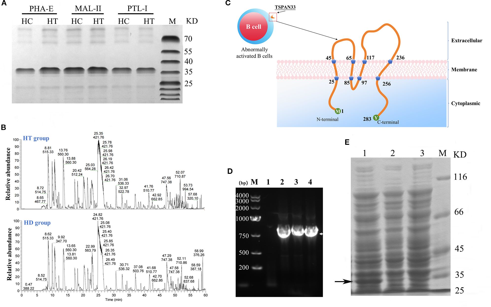 Gel electrophoresis and molecular diagrams in a scientific study. Section A shows a gel with bands labeled PHA-E, MAL-II, and PTL-I, with molecular weights from 10 to 180 kilodaltons. Section B includes two line graphs labeled HT group and HD group, showing relative abundance over time with peaks labeled with numbers. Section C illustrates a schematic of a B cell with TSPAN33 protein, featuring its location in the cell membrane and annotated sections. Section D is a gel image displaying DNA bands with a marker, labeled M and numerically 1 to 4, with sizes in base pairs. Section E shows another protein gel with bands for samples 1 to 10, with molecular weights from 10 to 180 kilodaltons.