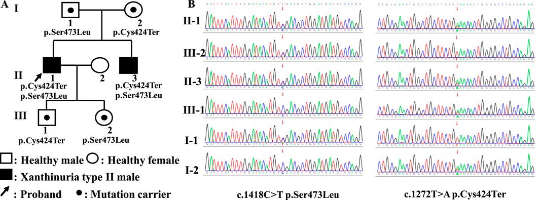 Pedigree chart and gene sequencing. The left panel shows a family tree with symbols representing individuals: squares for males, circles for females, filled for affected Xanthinuria type II and dots for mutation carriers. Labels indicate mutations p.Ser473Leu and p.Cys424Ter. The right panel displays DNA sequencing chromatograms for six individuals (II-1, III-2, II-3, III-1, I-1, I-2), highlighting mutations c.1418C>T (p.Ser473Leu) and c.1272T>A (p.Cys424Ter) with red arrows.