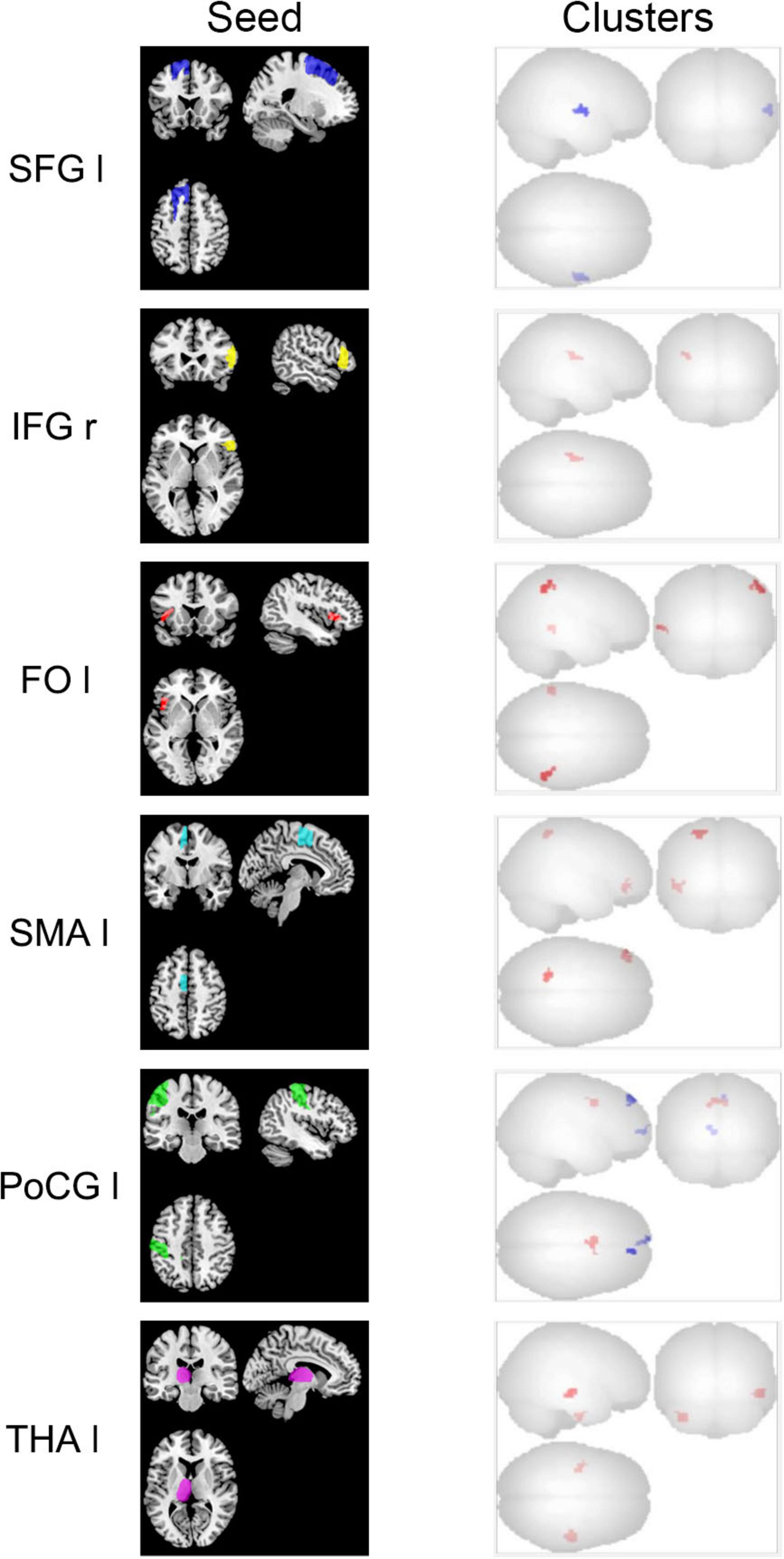 Brain scan images illustrating different seed regions and their corresponding clusters. On the left, seed regions are highlighted in various colors within brain slices: blue in SFG I, yellow in IFG r, red in FO I, cyan in SMA I, green in PoCG I, and magenta in THA I. On the right, clusters are shown on 3D brain models in matching colors.