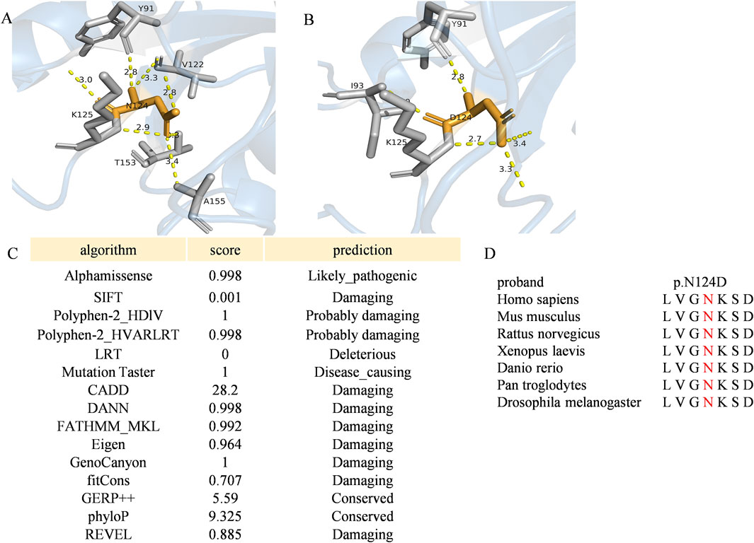 Molecular models A and B depict amino acid interactions with highlighted residues in orange amid a complex structure. Chart C lists algorithms with scores and pathogenicity predictions, such as “Likely pathogenic” and “Damaging” for the variant. Panel D shows a sequence alignment for p.N124D across species, with differences in red.