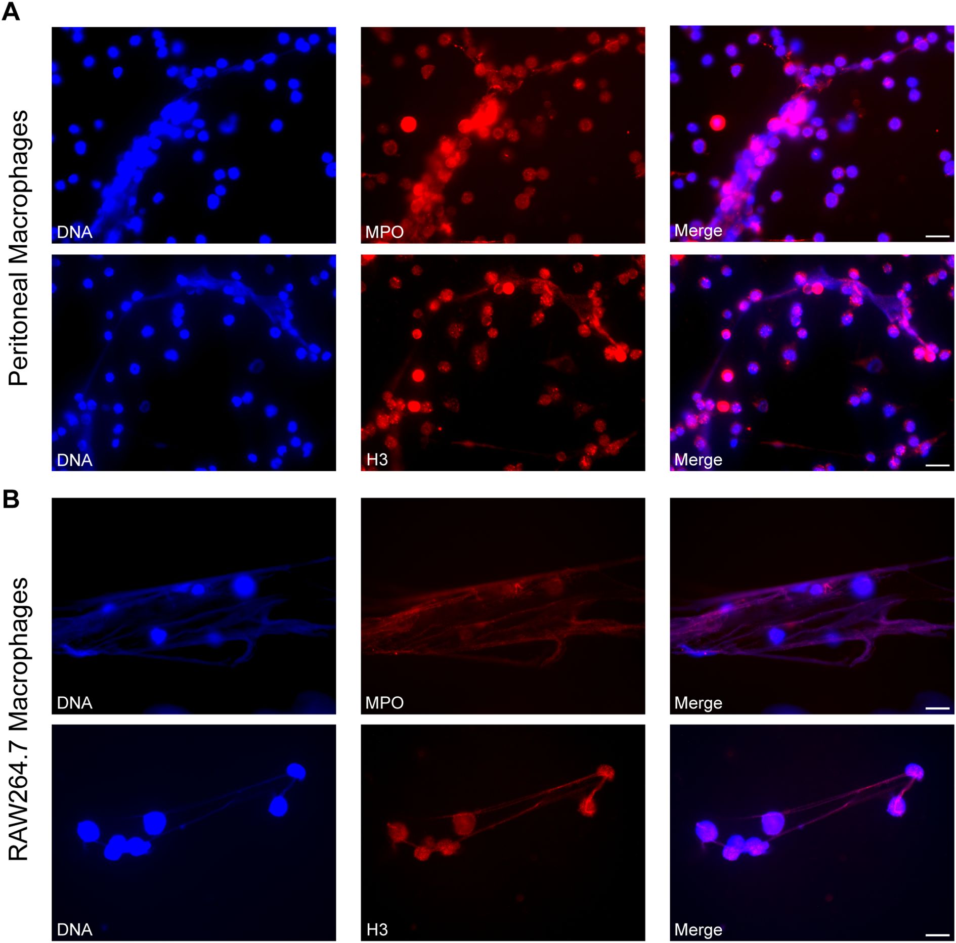 Fluorescent microscopy images showing peritoneal macrophages and RAW264.7 macrophages. Panel A (top) displays peritoneal macrophages stained for DNA (blue), MPO (red), and H3 (red), with merged images. Panel B (bottom) shows RAW264.7 macrophages similarly stained, demonstrating varied localization of the fluorescent markers.