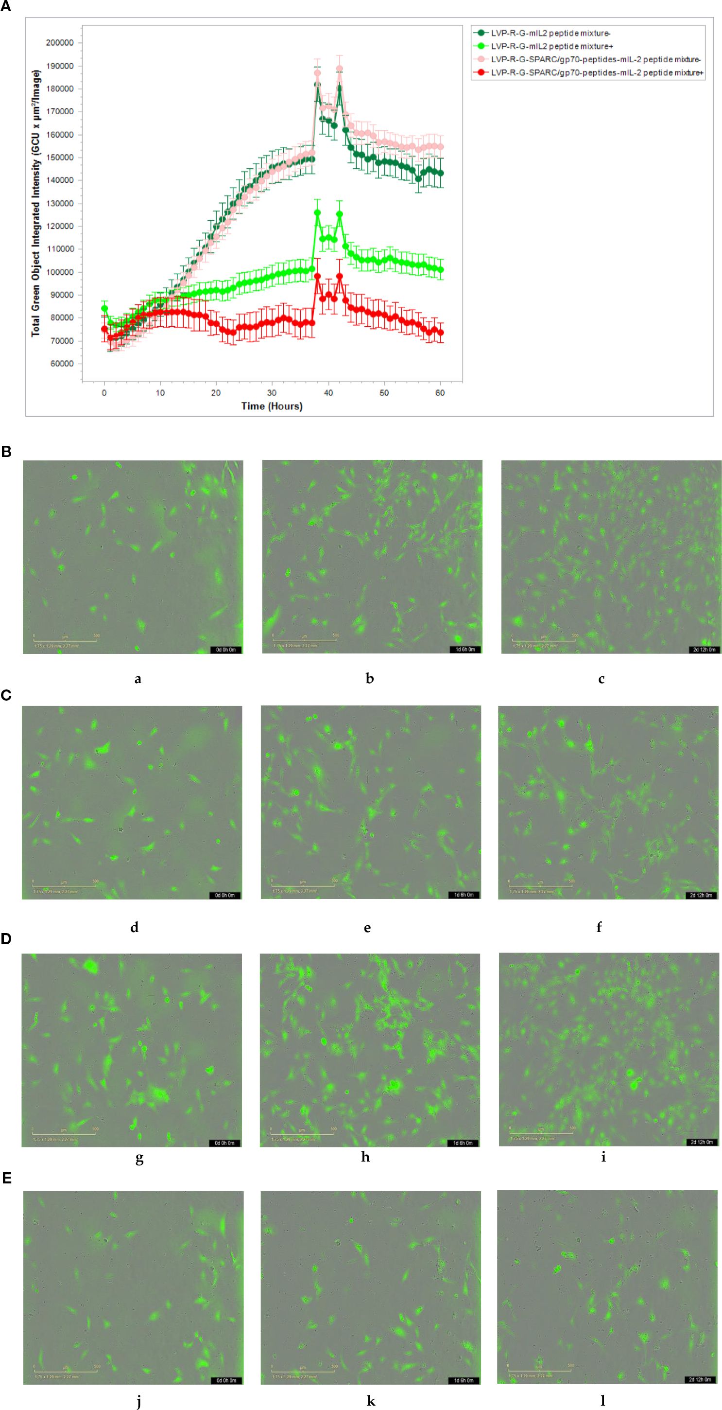 Graph A shows a line chart comparing total green object integrated intensity, which represents the area of N2C-Egfp cells in a cell culture plate, over time for different treatments: LVP-R-G-SPARC/grp70-peptides-mIL2 and LVP-R-G-mIL2. Sections B, C, D, and E contain microscopic images labeled a to l, showing N2C-Egfp cells co-cultured with CD8+ T cells (stimulated with or without peptides) from LVP-R-G-SPARC/grp70 peptides-mIL2 and LVP-R-G-mIL2 mice groups and monitored over time by incuCyte, indicating the killing efficiency of CD8+ T cells.