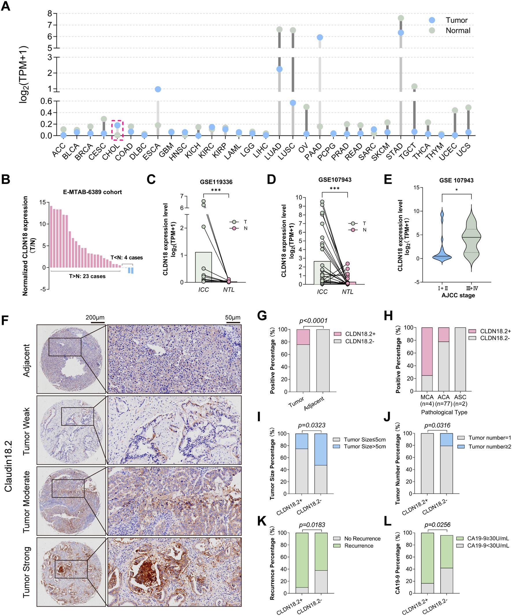 Composite image showing multiple panels related to CLDN18 expression in tumors. Panel A displays a bar graph comparing CLDN18 expression in various cancers. Panel B shows a bar graph of normalized CLDN18 expression across cases. Panels C and D have scatter plots for expression levels in ICC and NTL. Panel E presents a violin plot comparing expression by AJCC stage. Panel F contains microscopic images of tissue labeled as Adjacent, Tumor Weak, Moderate, Strong. Panels G to L contain bar graphs showing statistical data on CLDN18 status related to positive percentage, tumor size, number, recurrence, and CA19-9 levels.