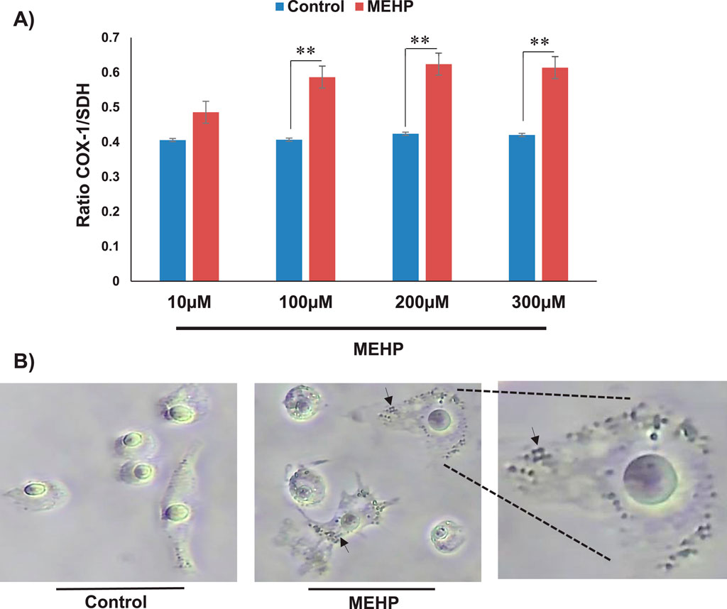 A) Bar graph comparing the ratio of COX-1 to SDH in control (blue) and MEHP (red) at varying concentrations (10, 100, 200, and 300 micromolar). MEHP shows a significantly higher ratio at 100, 200, and 300 micromolar, indicated by double asterisks. B) Microscopic images show control cells and MEHP-treated cells with observable changes. MEHP-treated cells exhibit more irregularities, with arrows highlighting specific cellular alterations.