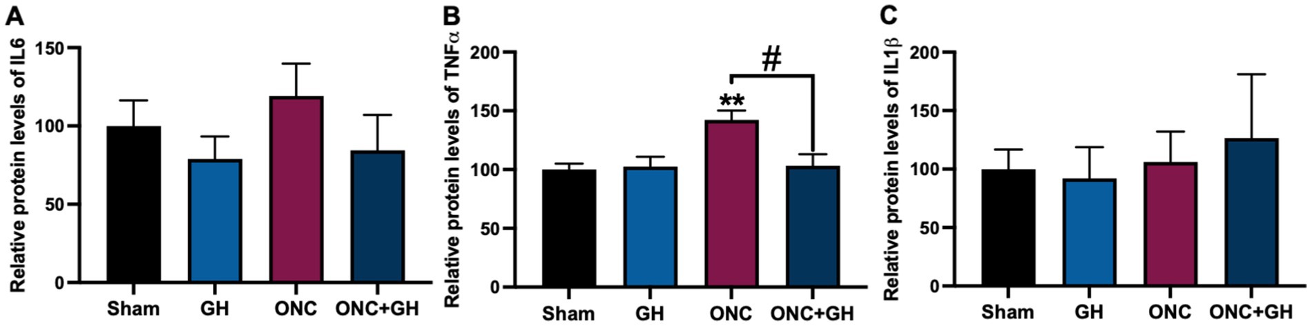 Bar graphs showing relative protein levels for IL6, TNFα, and IL1β. Panel A shows similar IL6 levels across Sham, GH, ONC, and ONC+GH groups. Panel B shows TNFα levels higher in ONC compared to others; ONC is marked with ** and #. Panel C shows comparable IL1β levels among the groups. Error bars indicate variability.
