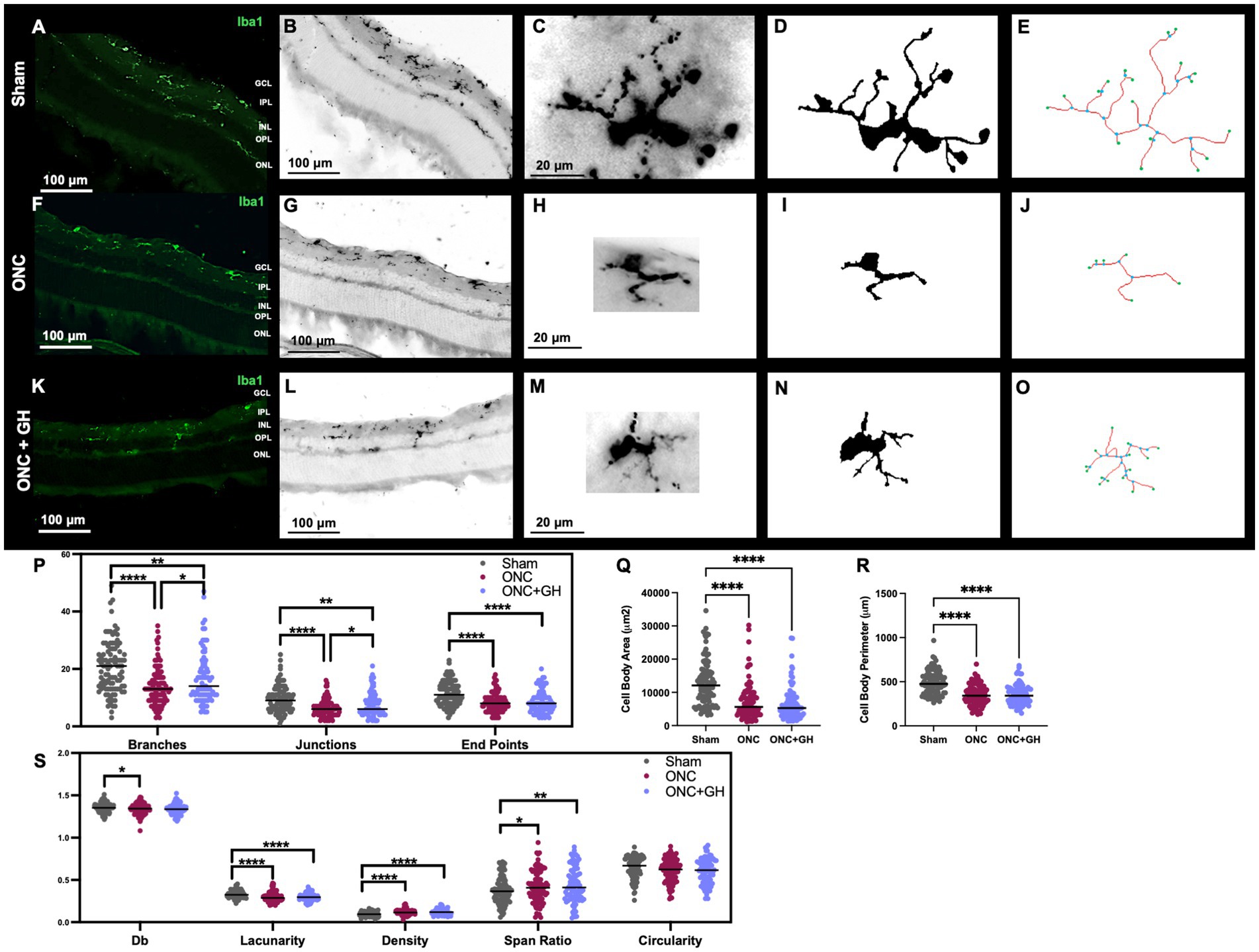 Microglial cells in retinal tissue from three groups: Sham (A-E), ONC (F-J), and ONC plus GH (K-O). Panels show microglial staining (A, F, K), detailed images (B, G, L and C, H, M), cell morphology (D, I, N), and branch mapping (E, J, O). Graphs (P-S) compare various metrics such as branches, junctions, endpoints, cell body area, perimeter, and structural features among groups, with statistical significance indicated by asterisks.