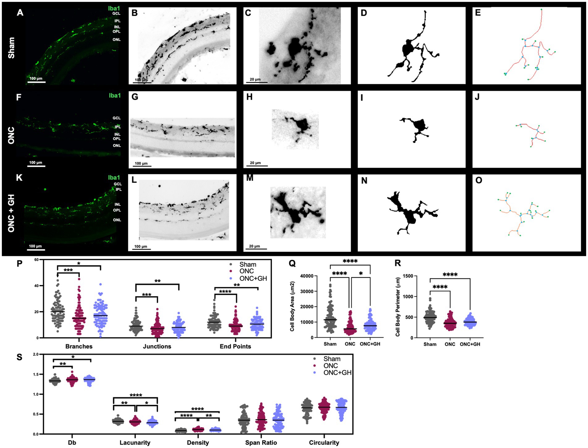 Microscopic images and analysis of retinal layers and cell structures under different treatments, labeled Sham, ONC, and ONC+GH. Panels A-O display immunofluorescence and traced maps. Graphs P-S present statistical analyses, comparing branches, junctions, endpoints, cell body area, perimeter, and other morphological parameters across treatments. Statistical significance is indicated by asterisks.
