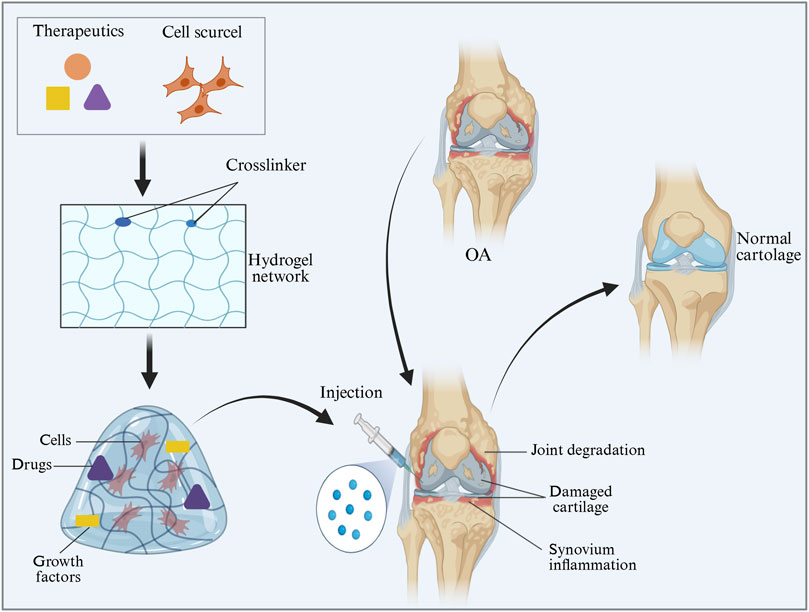 Diagram illustrating a therapeutic process for osteoarthritis (OA). Top left shows therapeutics and cells forming a hydrogel network via crosslinkers. The network contains cells, drugs, and growth factors. The hydrogel is injected into a knee with joint degradation, damaged cartilage, and synovium inflammation. The process aims to restore normal cartilage structure, as shown on the right.