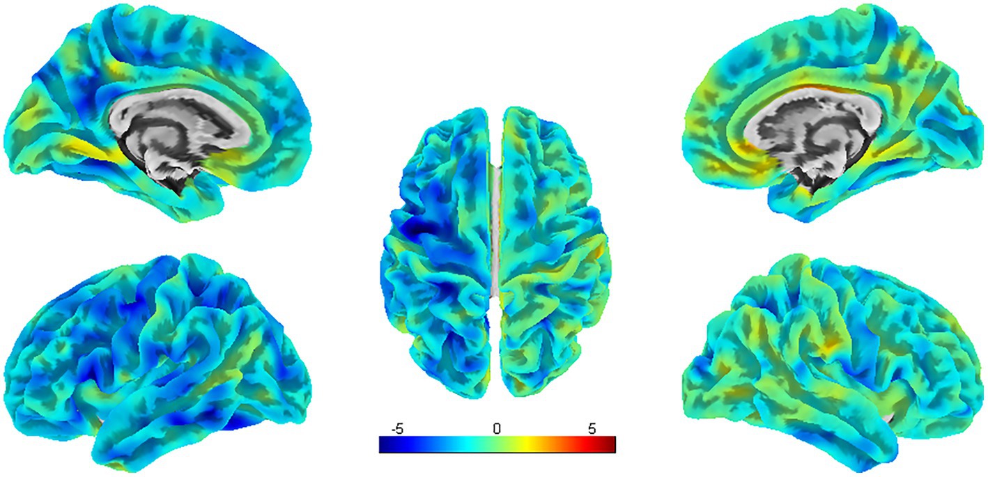 Visualizations of brain activity show lateral and medial views of the left and right hemispheres, colored to represent activity levels. A color scale ranges from blue (-5) to red (5).