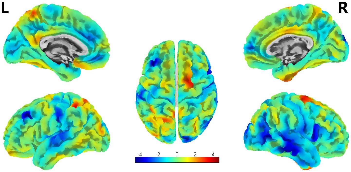 Colored brain imaging displays multiple views of cerebral cortex activity, with a color scale from blue to red indicating varying levels of activity or connectivity. The images illustrate the left (L) and right (R) hemispheres from different angles, with a top-down central view.