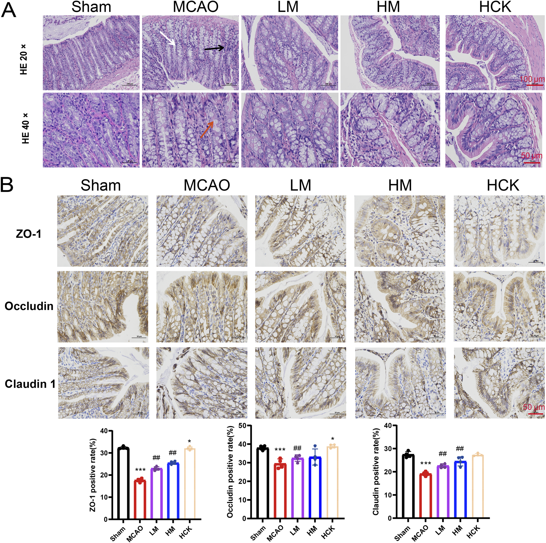 Histological analysis showing intestinal tissue samples across different conditions: Sham, MCAO, LM, HM, and HCK. Panel A illustrates hematoxylin and eosin staining at two magnifications (twenty times and forty times). Panel B shows immunohistochemical staining for ZO-1, Occludin, and Claudin 1. Bar graphs depict the positive rate percentages for each protein, indicating changes in expression across conditions.