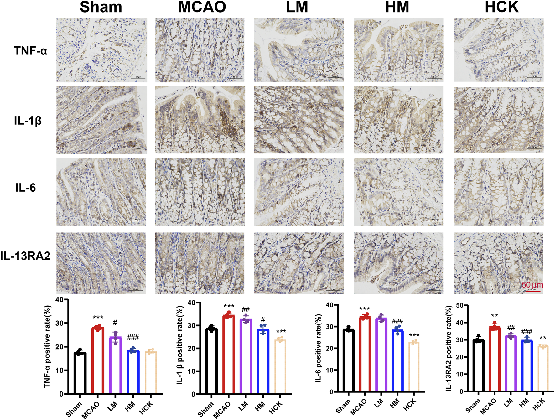 Histological images and bar graphs displaying TNF-α, IL-1β, IL-6, and IL-13RA2 positive rates in Sham, MCAO, LM, HM, and HCK groups. Bar graphs indicate significant differences in expression levels among these groups, with symbols denoting statistical significance.