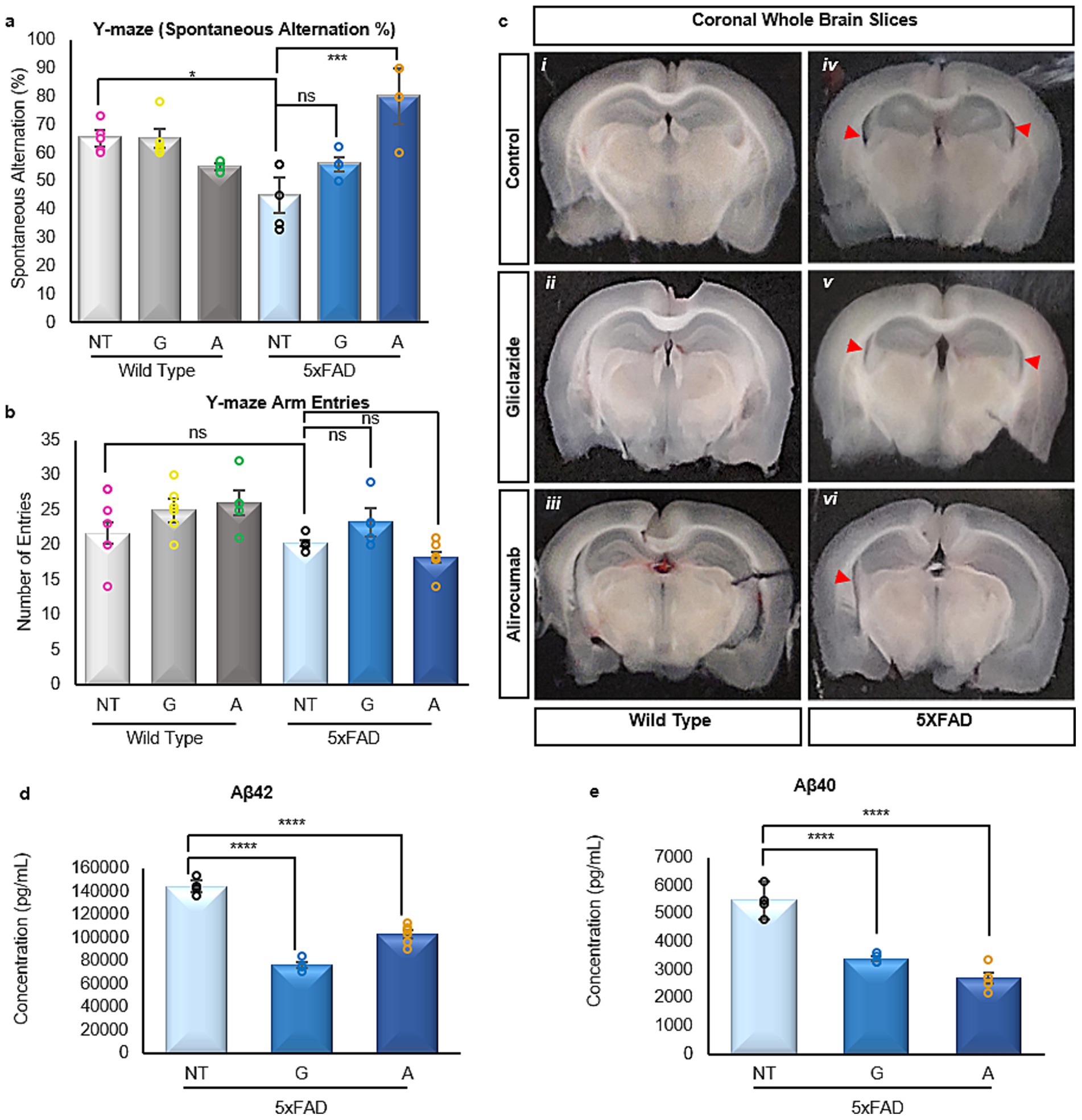 Bar charts and brain images explore various data related to Alzheimer’s research in mice. In (a) and (b), charts show Y-maze spontaneous alternation percentages and arm entries for wild type and 5xFAD mice under different conditions. (c) Coronal whole brain slices compare different treatment effects. (d) and (e) charts present concentrations of Aβ42 and Aβ40 in 5xFAD mice across conditions. The data emphasize treatment effects on behavior and pathology, with significant differences noted in specific comparisons.